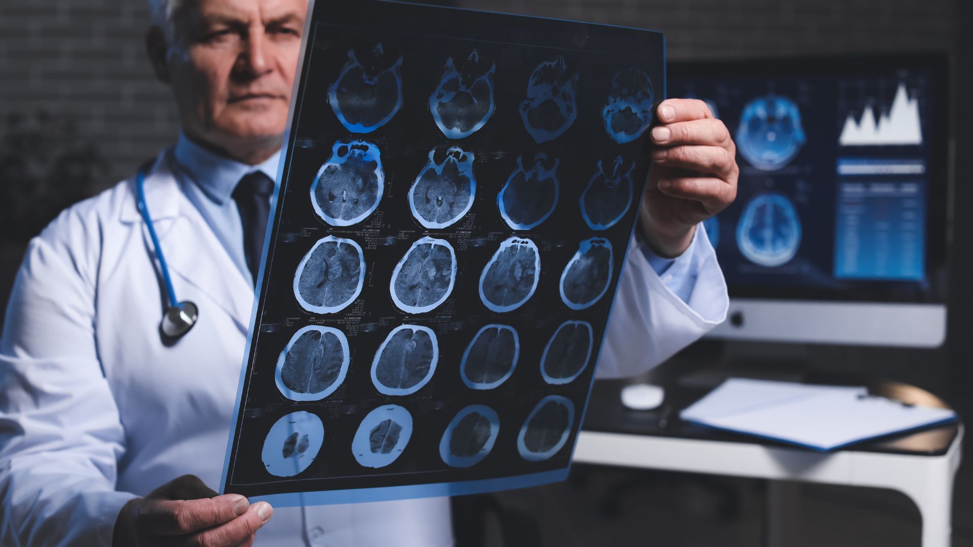 Bác sĩ có thể chỉ định người bệnh thực hiện một số xét nghiệm cận lâm sàng