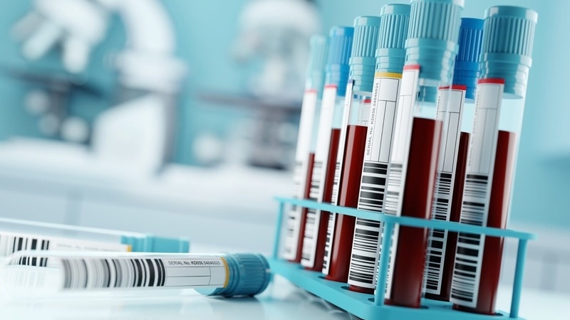 Xét nghiệm EBV thường được chỉ định khi người bệnh có triệu chứng nghi ngờ nhiễm virus