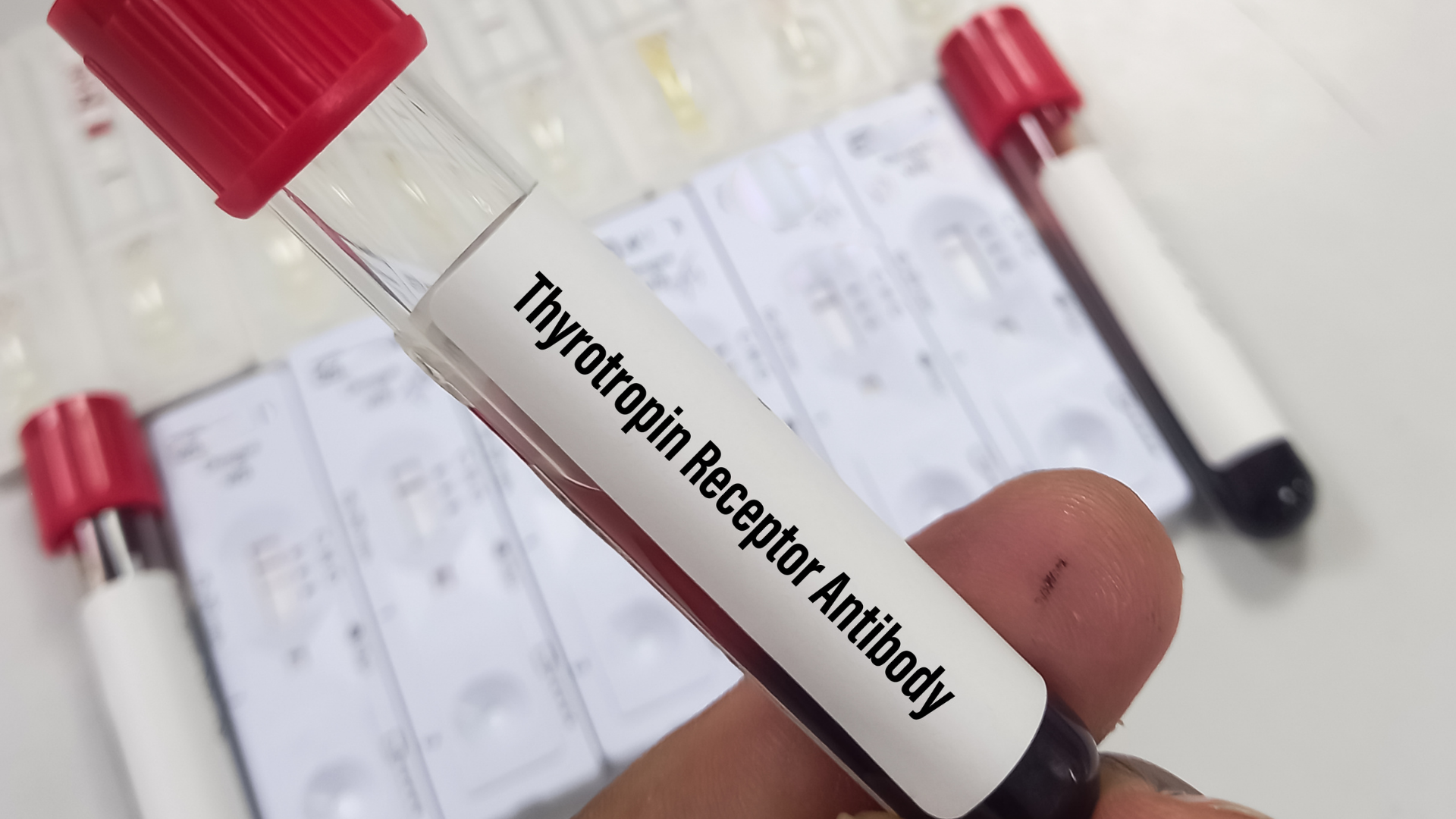 Có những loại kháng thể tuyến giáp nào?