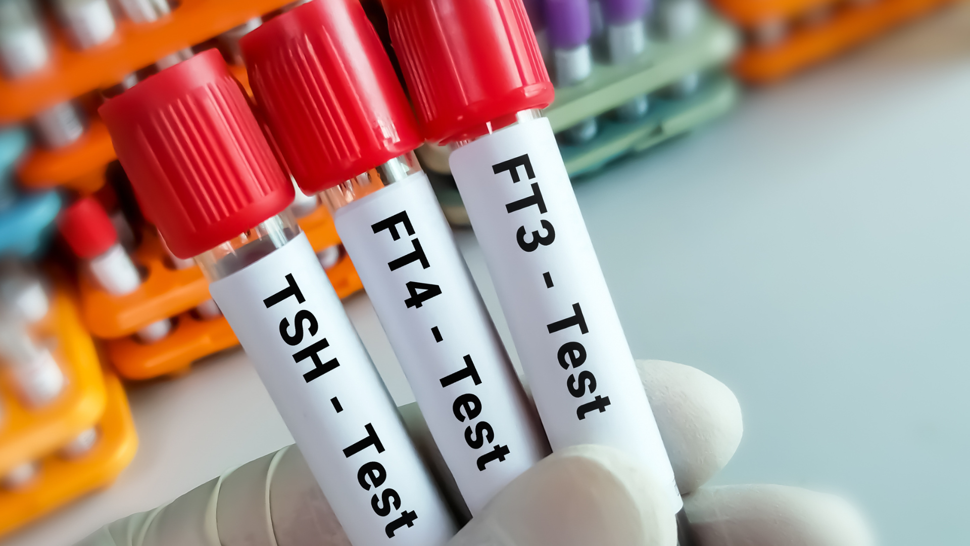 Chỉ số kháng thể tuyến giáp bao nhiêu là bình thường?