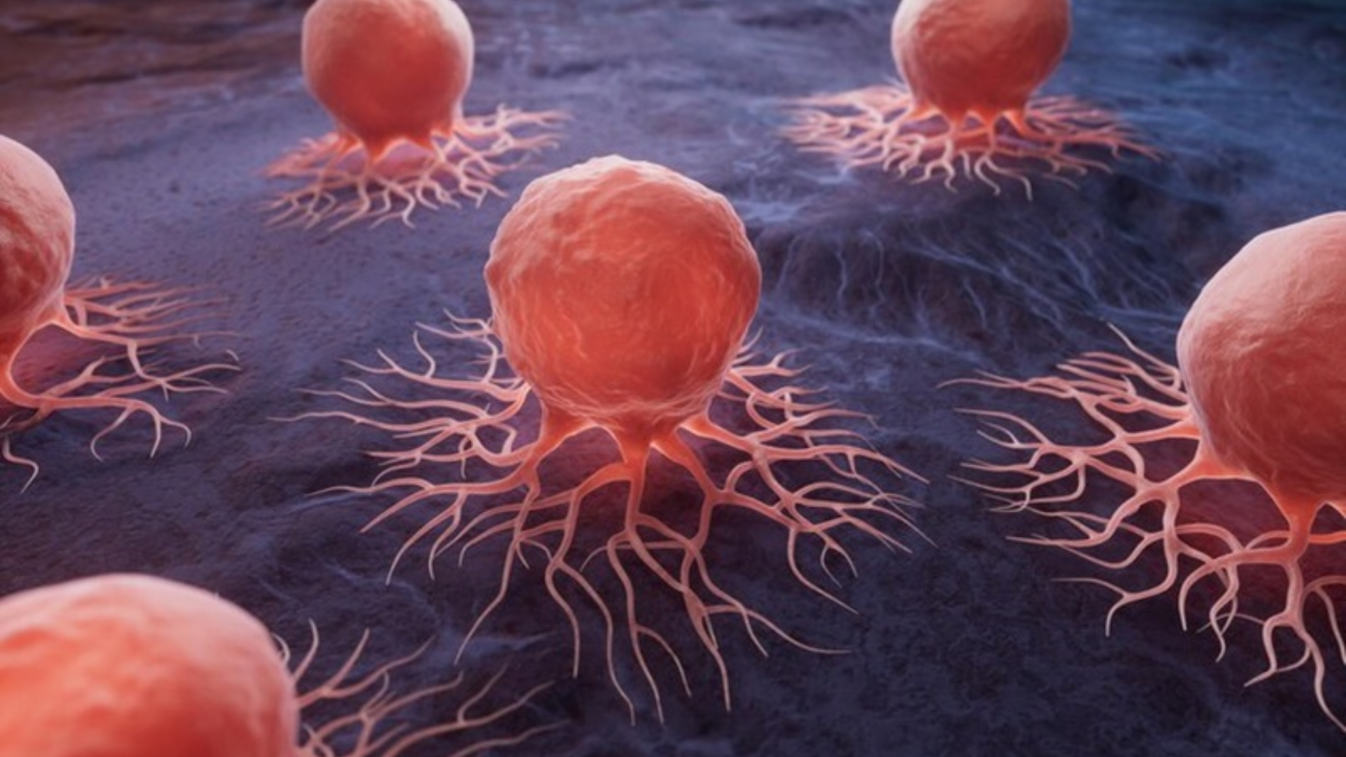 Khối u ác tính có chữa được không? Vẫn có thể chữa khỏi nếu phát hiện sớm và điều trị đúng phương pháp