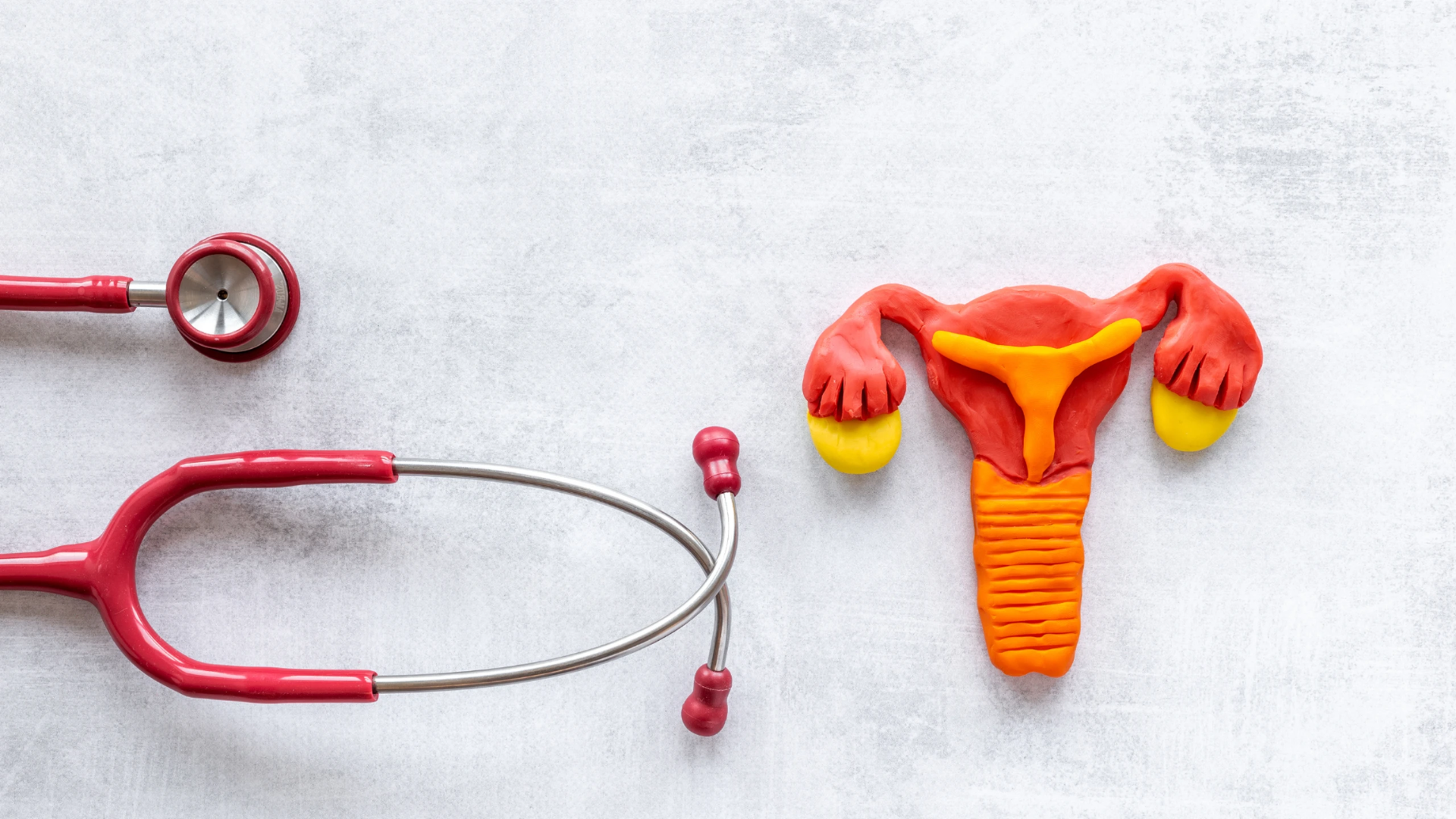 U xơ tử cung thường không tự tiêu, khám định kỳ giúp kiểm soát kích thước và biến chứng