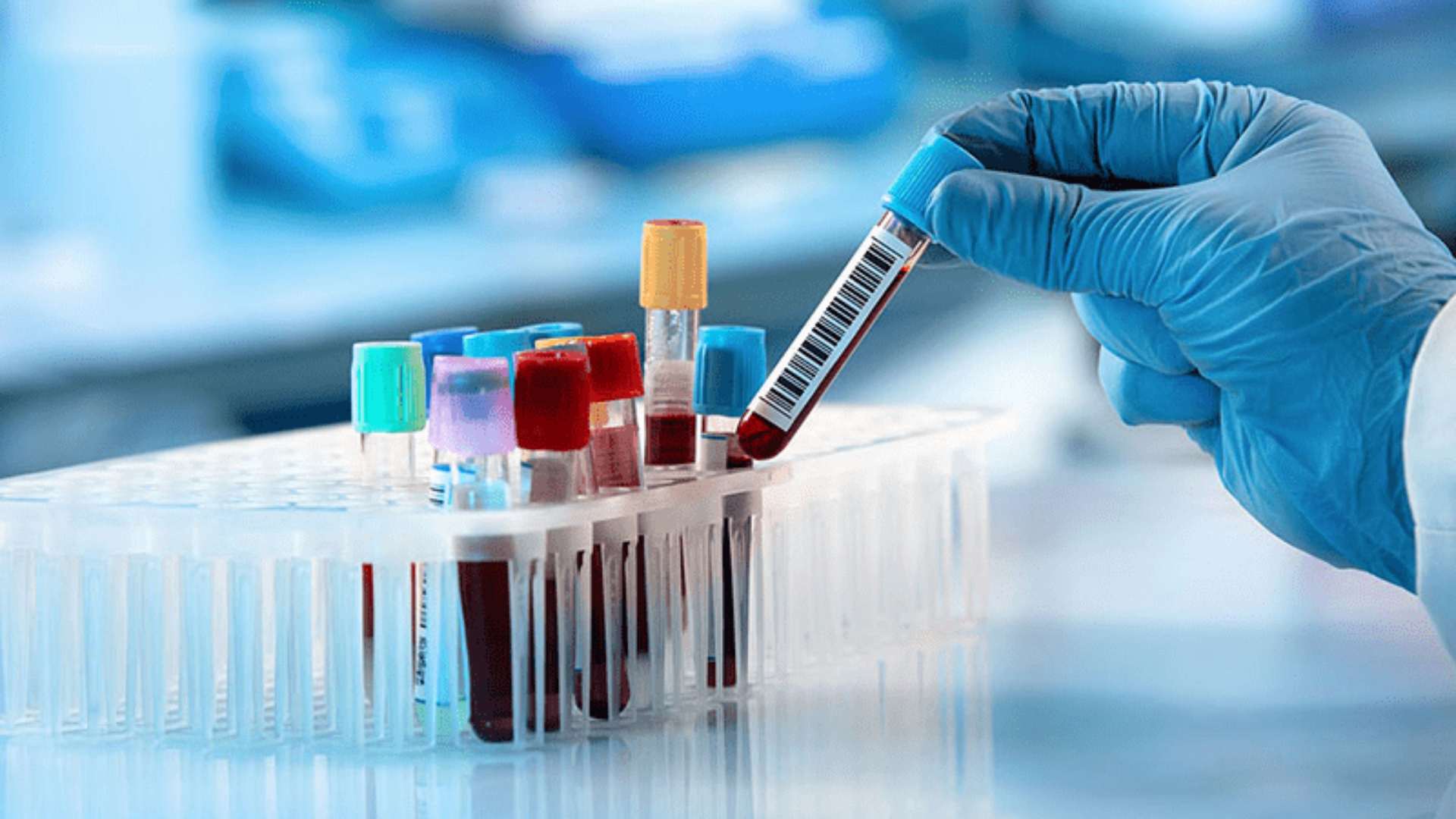 Xét nghiệm máu giúp kiểm tra hoạt động tuyến giáp, phát hiện dấu ấn ung thư khi cần thiết