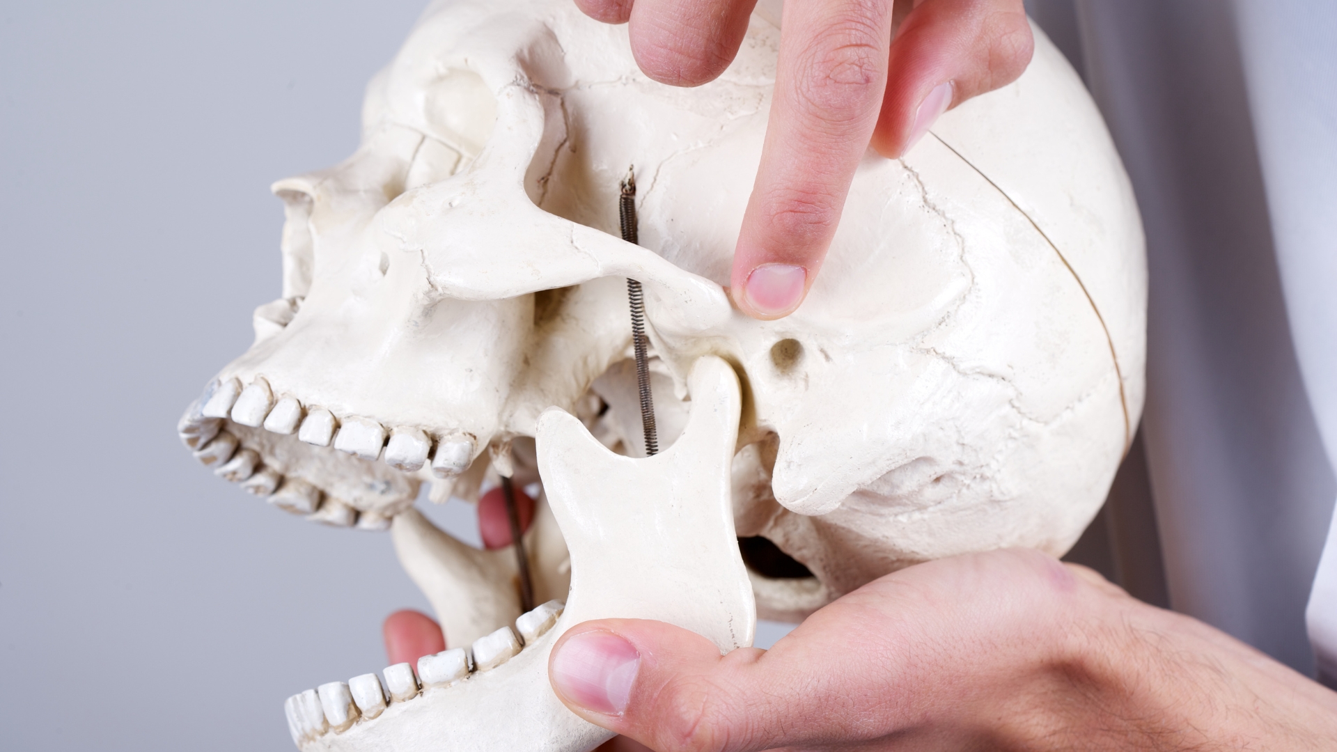 Khớp cắn ngược loại 3: Nhận diện và giải pháp điều trị hiệu quả 4