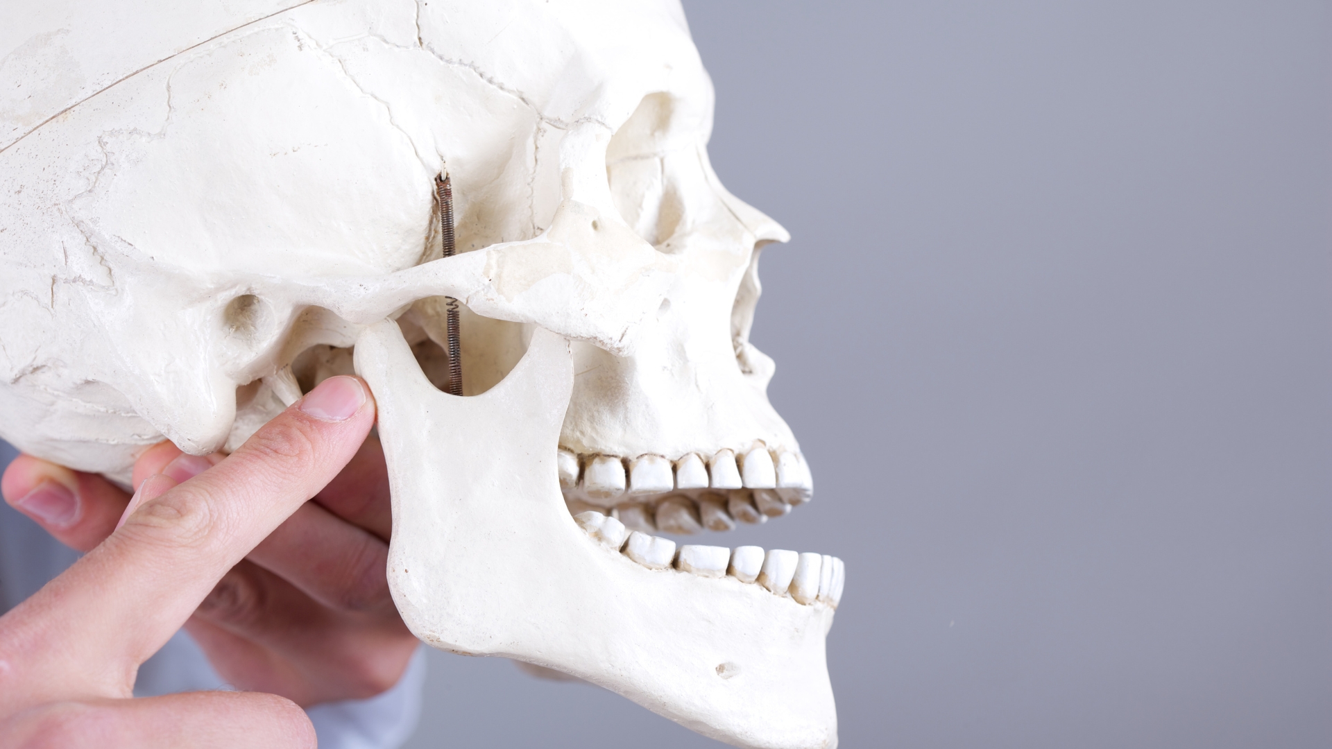 Khớp cắn ngược nhẹ: Tình trạng dễ bị bỏ qua và hệ lụy khó lường 2