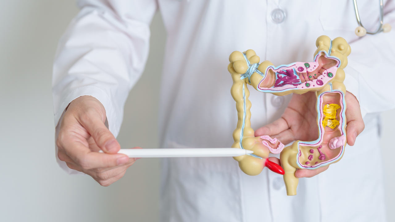 Việc xác định trường hợp nào nên cắt polyp đại tràng tuỳ theo chỉ định của bác sĩ