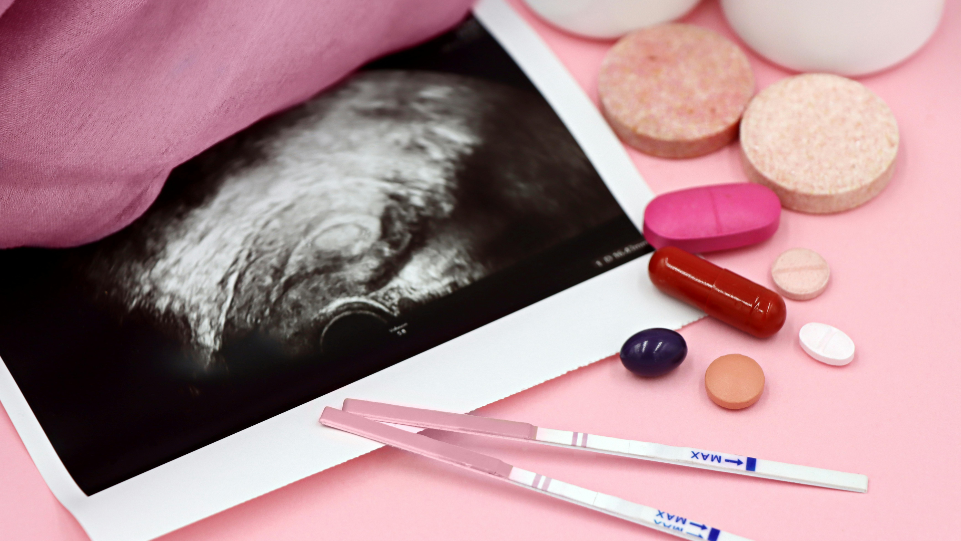 Khi u nang buồng trứng phát triển lớn, quá trình rụng trứng có thể rối loạn, khả năng thụ thai tự nhiên giảm