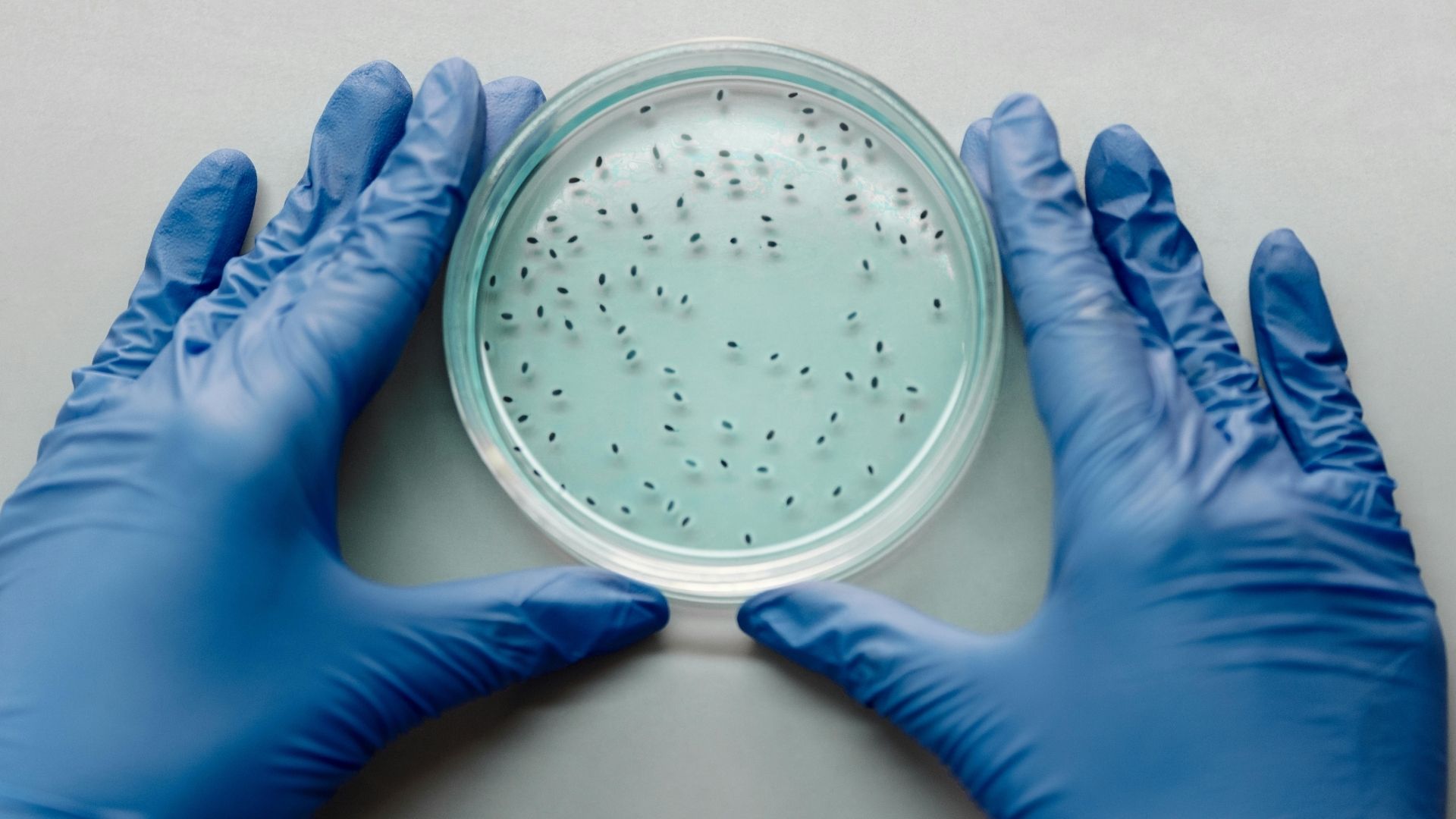 Kiết lỵ có thể do vi khuẩn hoặc amip