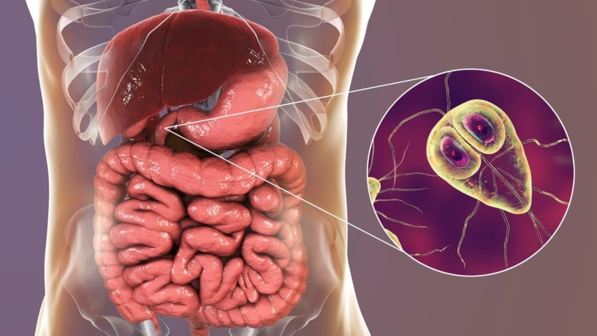 Ký sinh trùng đường ruột sống nhờ trong cơ thể người, âm thầm lấy chất dinh dưỡng và gây hại sức khỏe