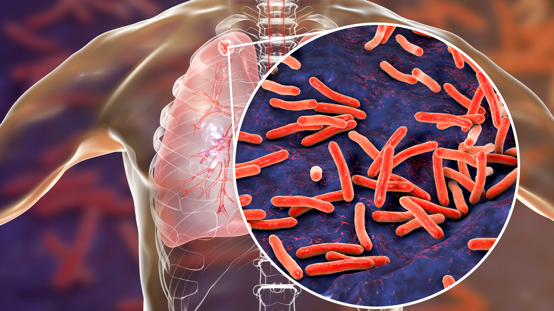 ky-thuat-tiem-lao-cho-tre-so-sinh-nhu-the-nao 4.png