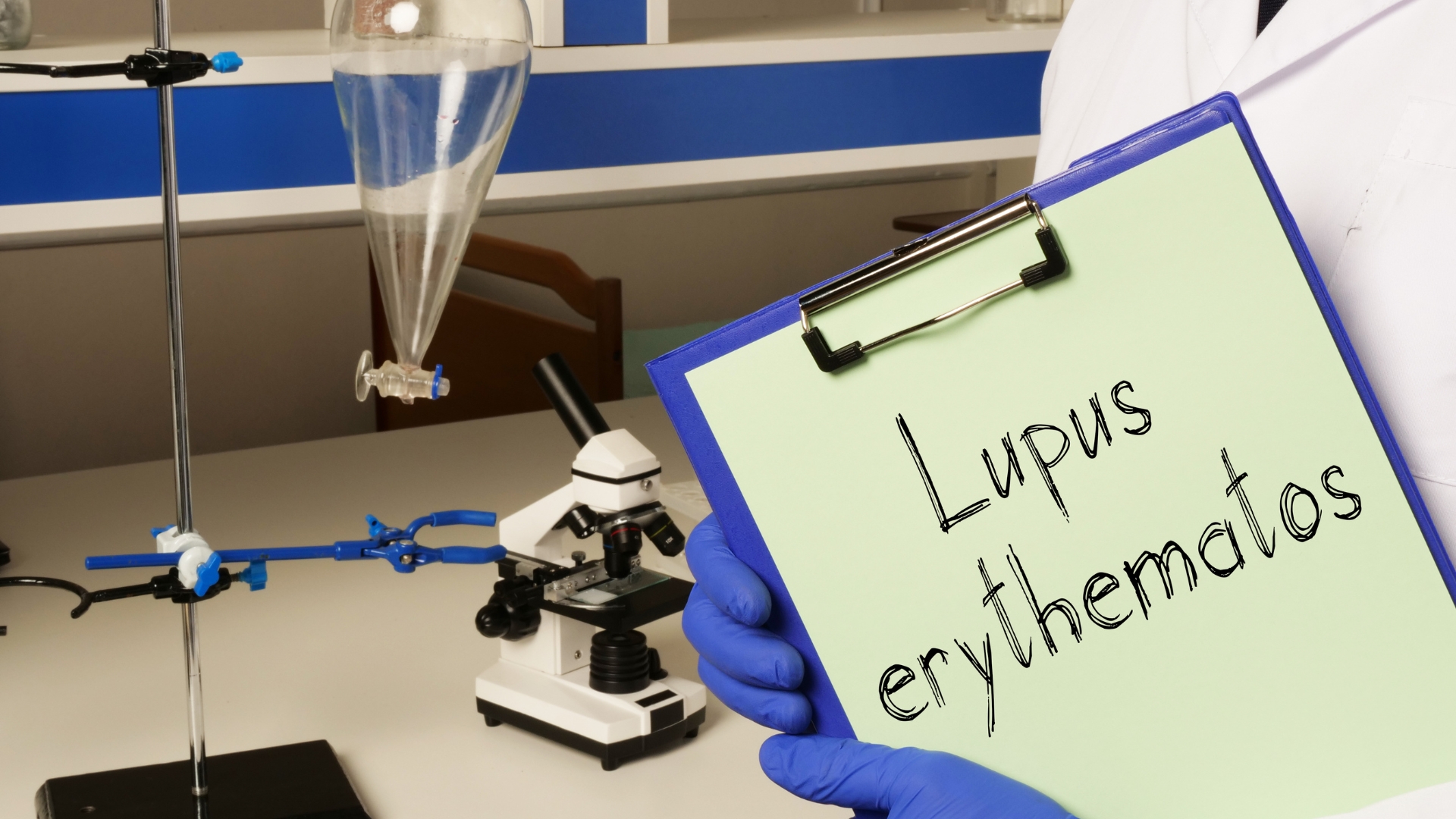 Phản ứng miễn dịch bất thường do lupus ban đỏ cũng có thể khiến lách to