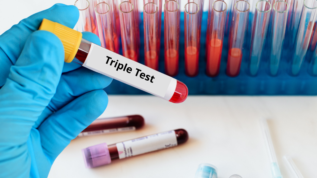 Làm double test rồi có cần làm triple test không?