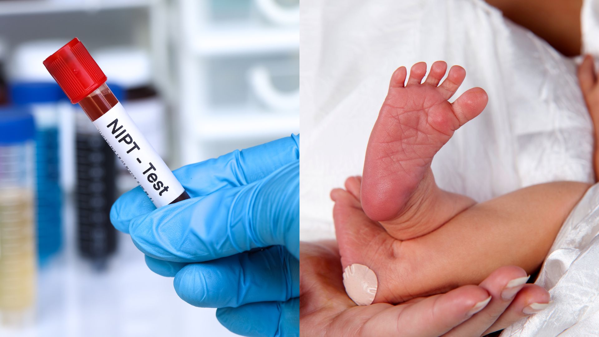 Xét nghiệm NIPT và máu gót chân có nhiều điểm khác biệt