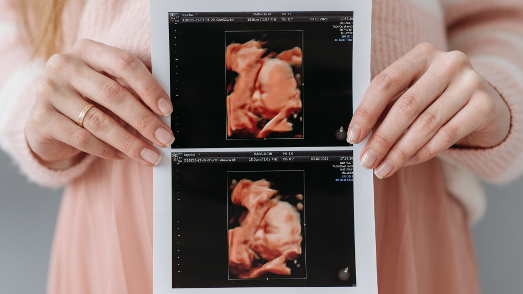 Việc kiểm tra đúng thời điểm giúp kết quả đo chính xác hơn, hạn chế sai lệch do tư thế thai nhi hoặc các yếu tố khác