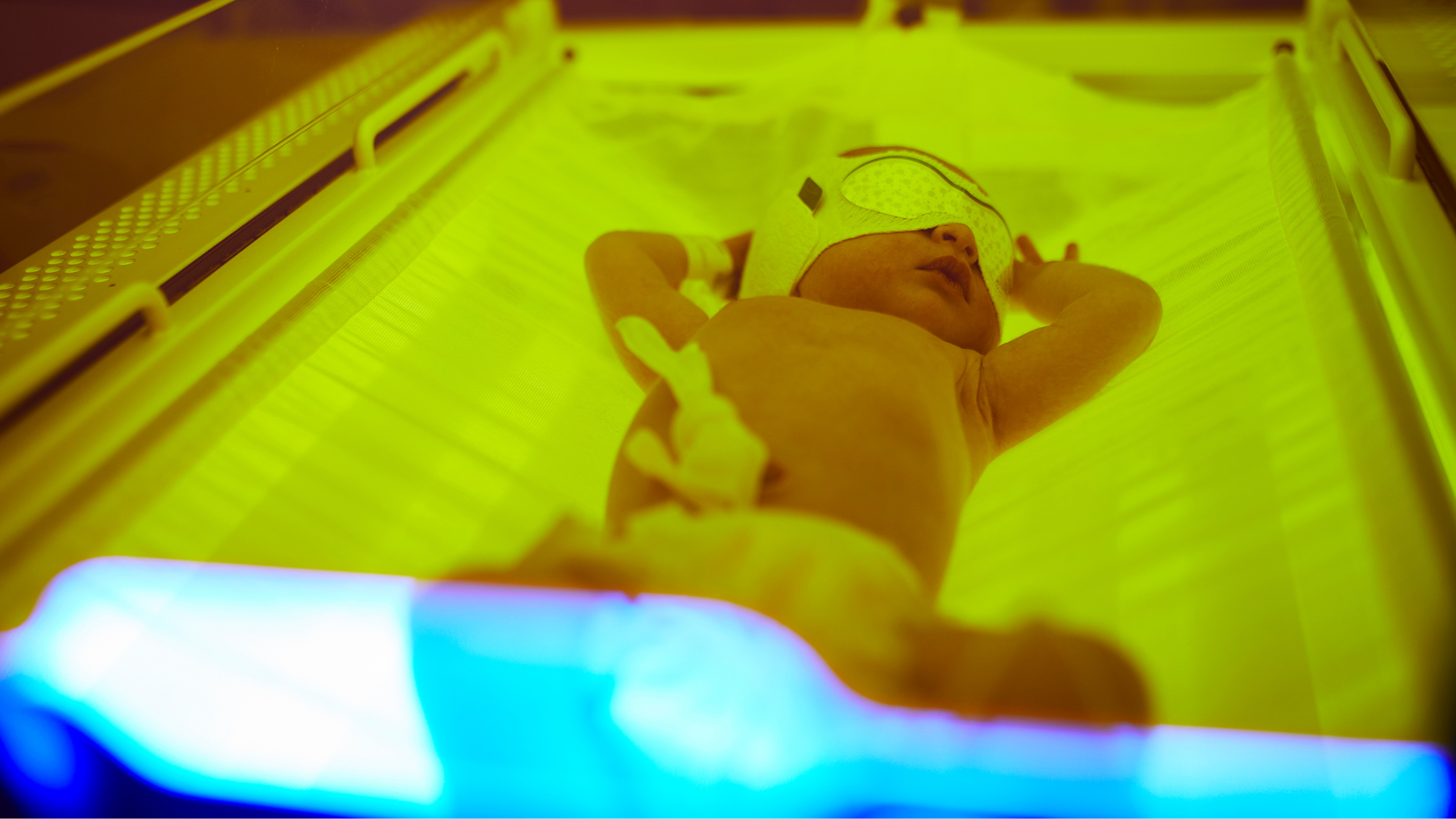 Vàng da kéo dài có nguy cơ gây tổn thương não