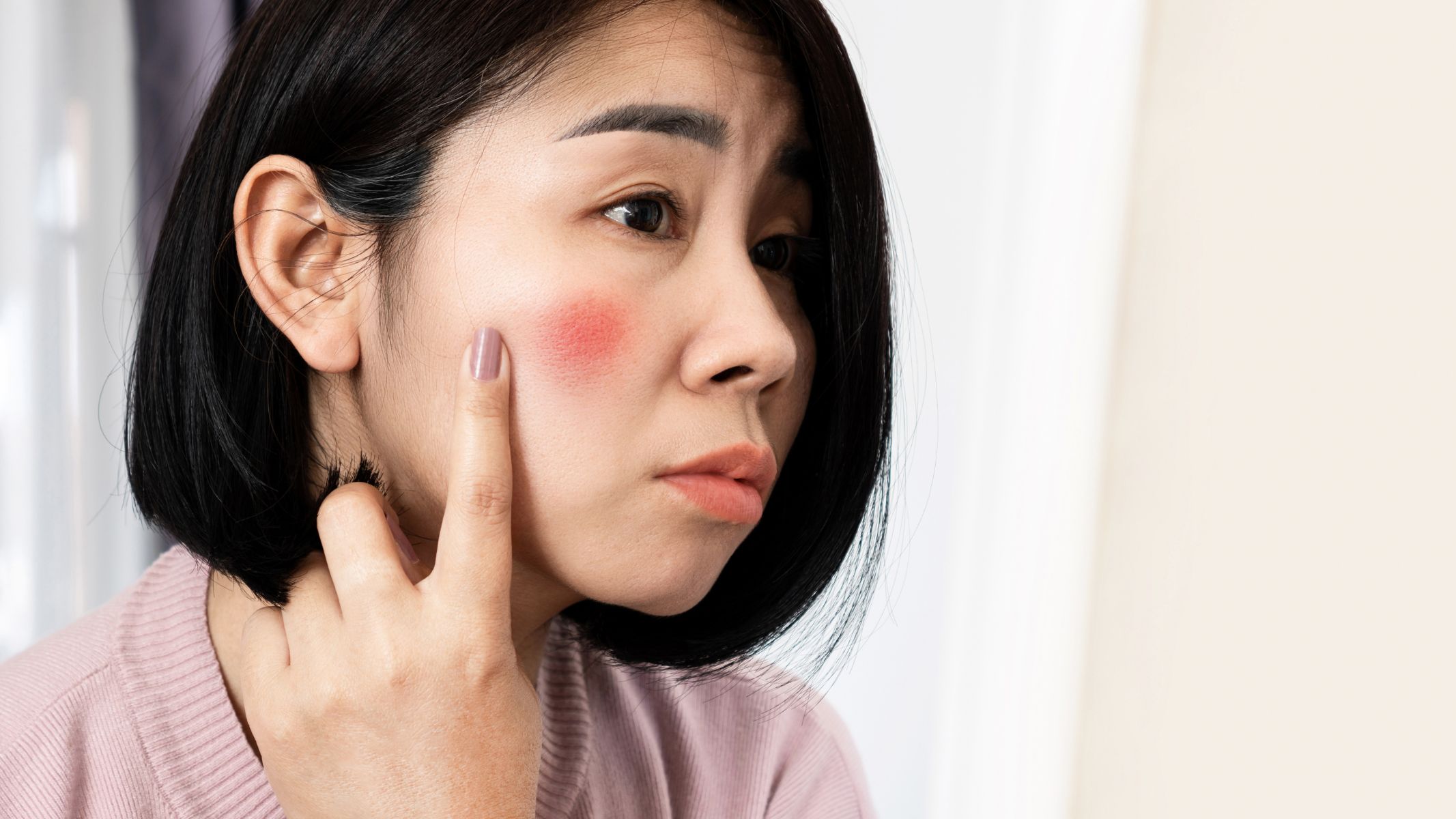 Lang ben ở mặt có khó trị không? Cách điều trị 2