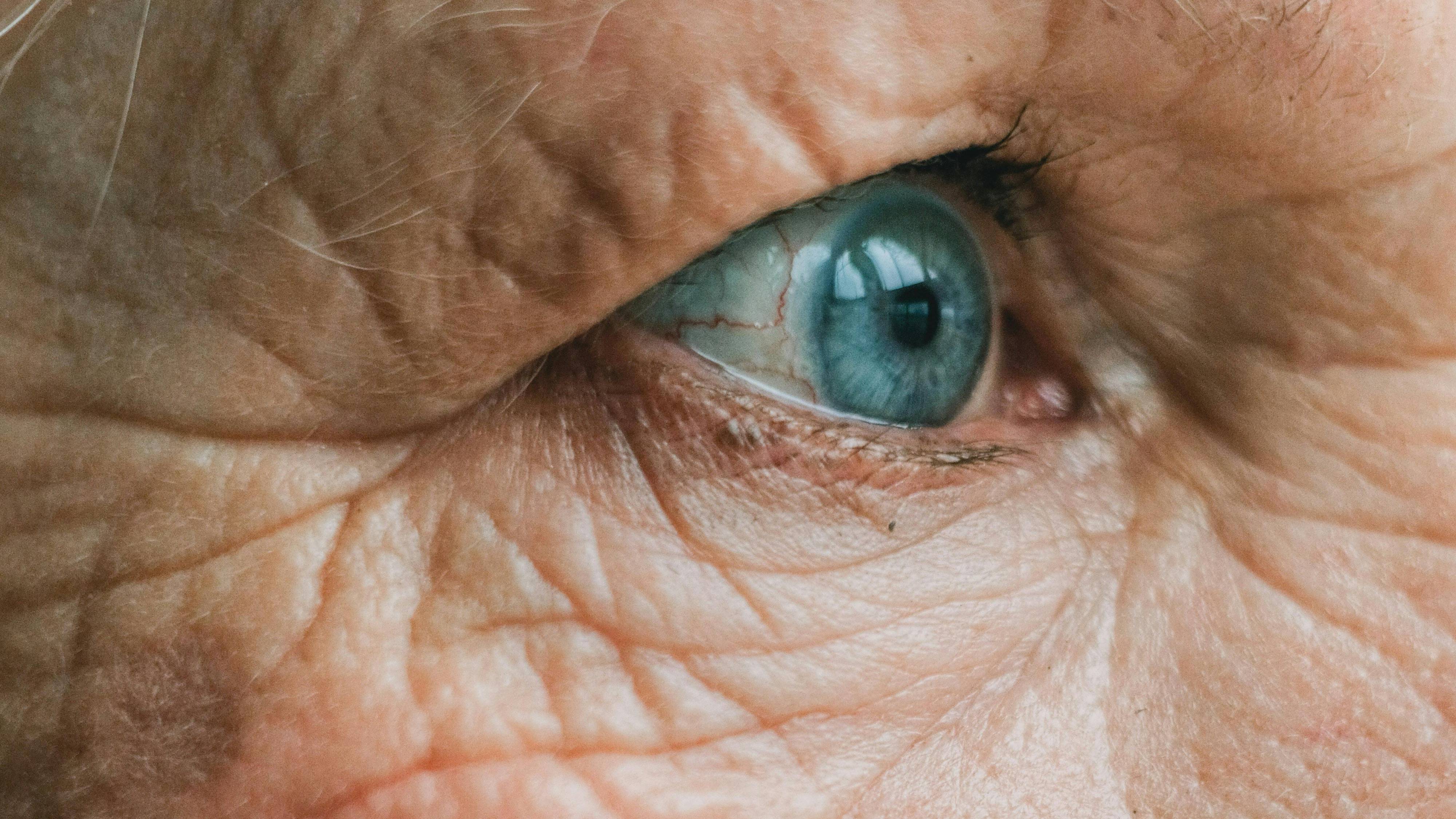 Các dấu hiệu lão hóa trở nên rõ rệt hơn ở độ tuổi 35 như xuất hiện nếp nhăn hoặc da khô sạm