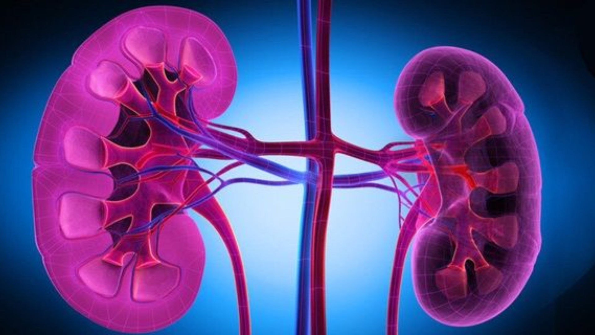 Lao thận là dạng lao ngoài phổi nguy hiểm, ảnh hưởng trực tiếp chức năng thận nếu không điều trị kịp thời