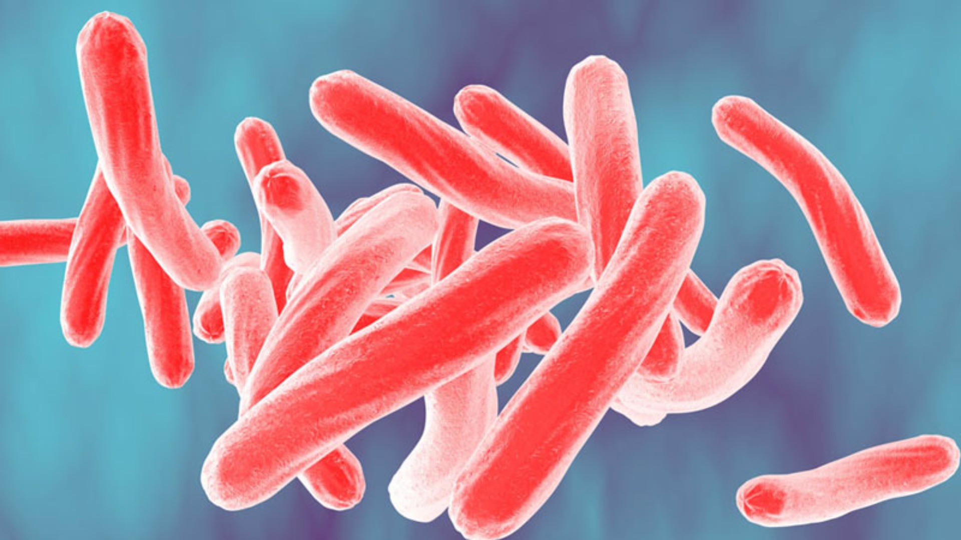 Mycobacterium tuberculosis xâm nhập qua đường thở, gây lao phổi và âm thầm ảnh hưởng đến thận