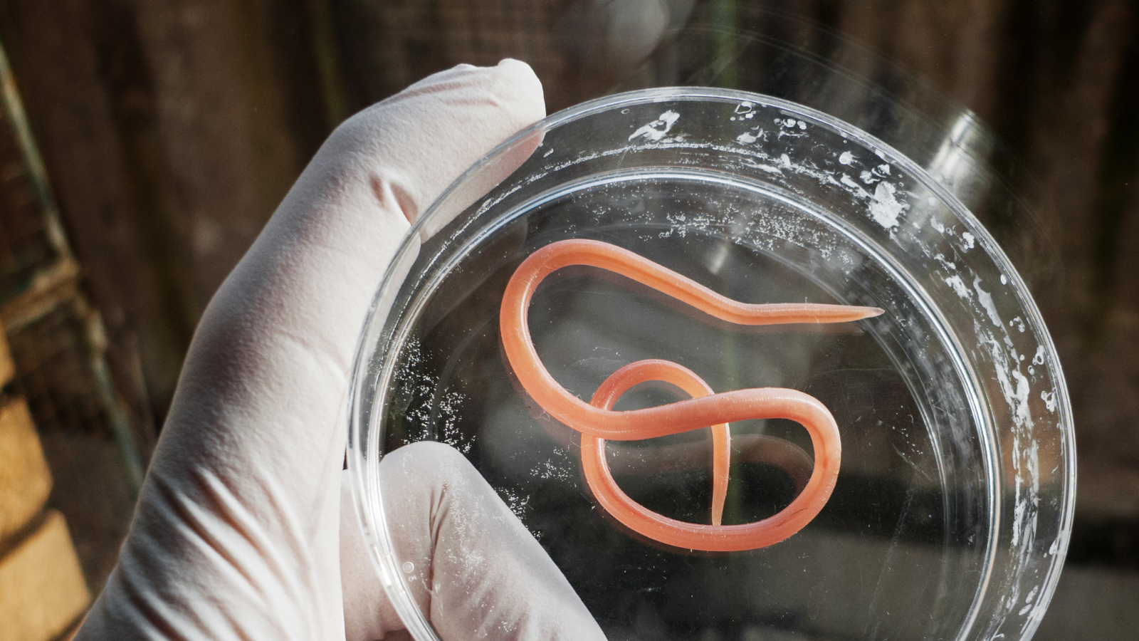 Giun sán di chuyển sang cơ quan khác, gây biến chứng nguy hiểm