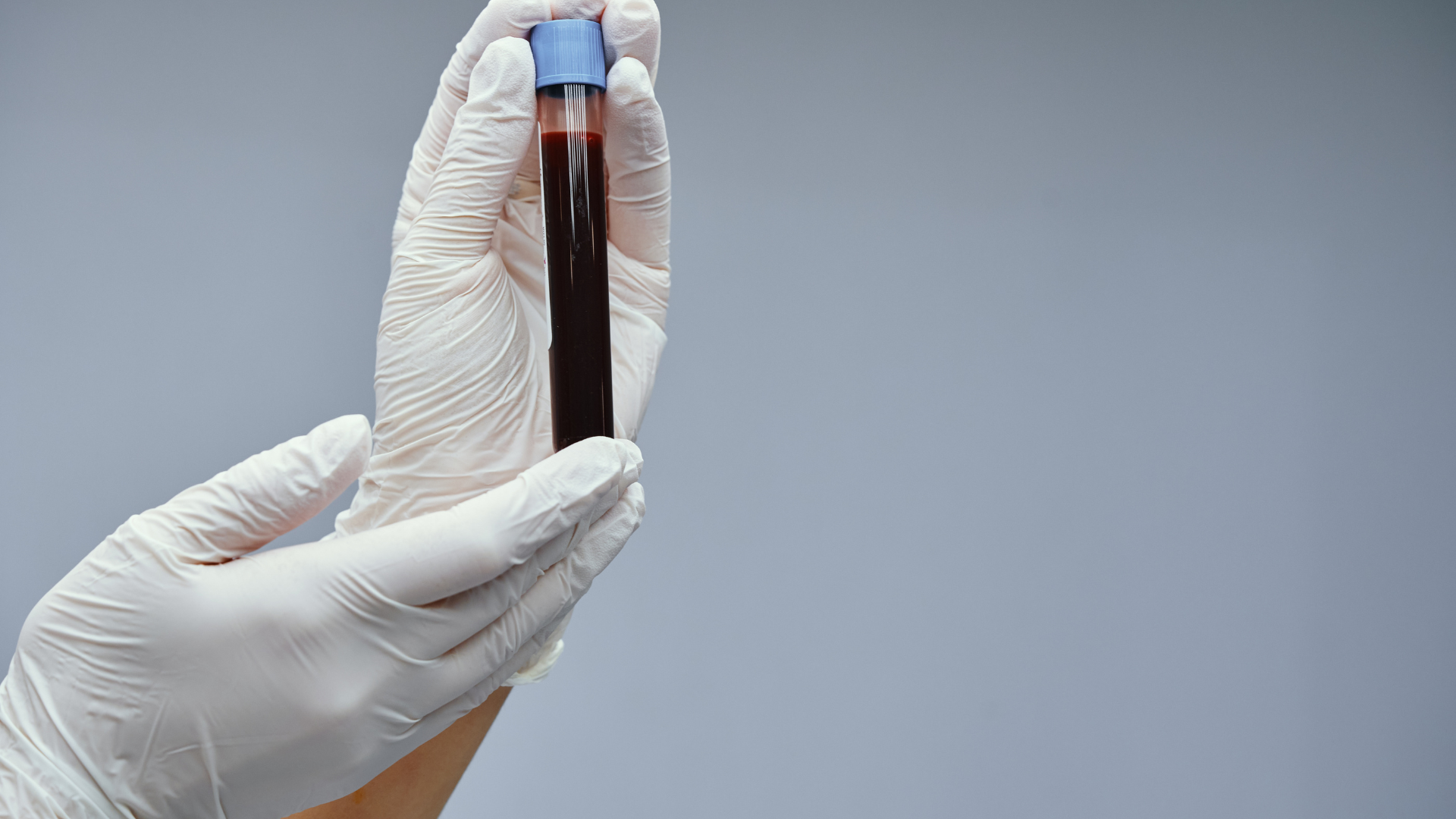 Giải đáp thắc mắc thường gặp khi đi xét nghiệm máu