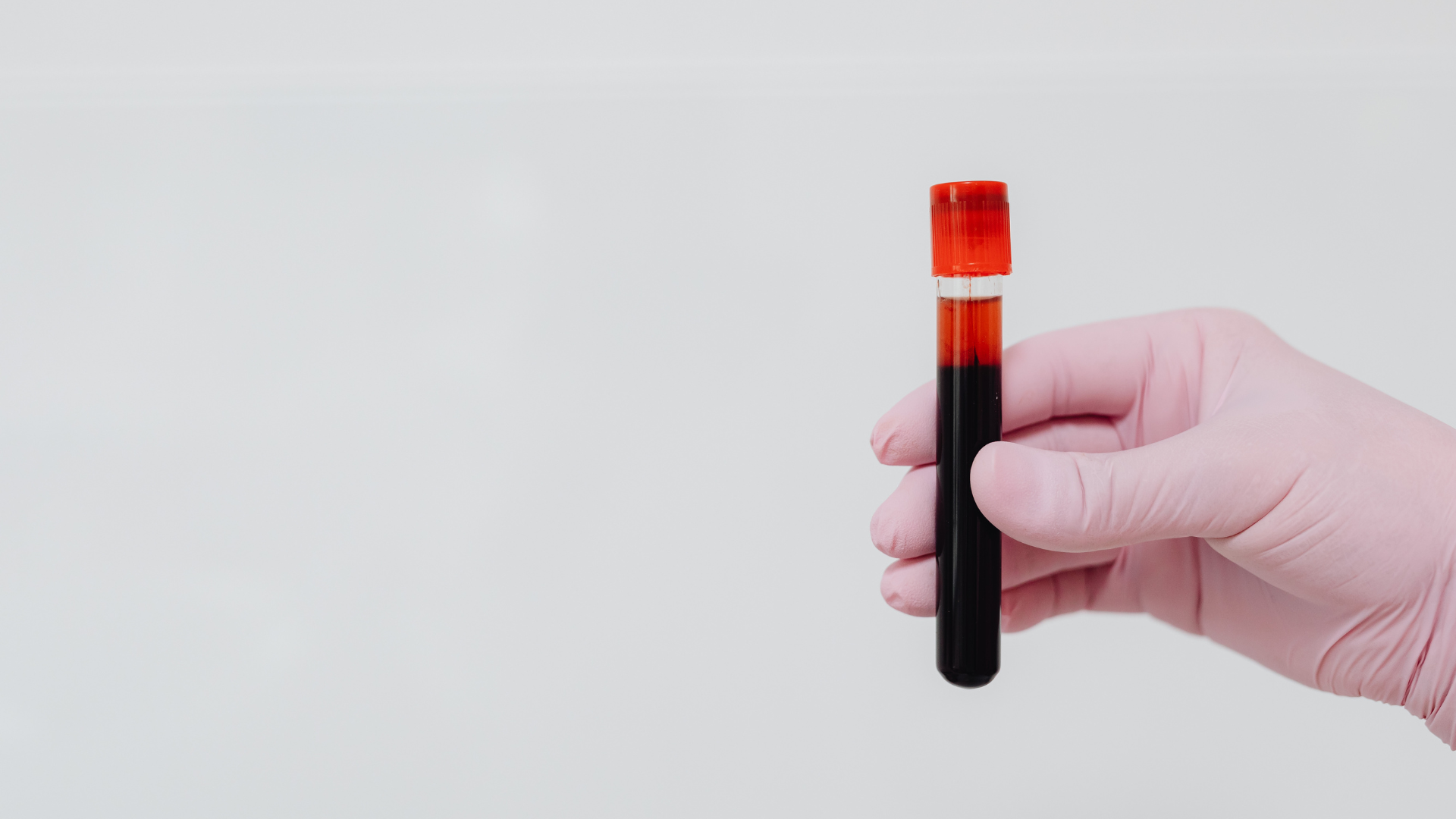 Một số phản ứng nhẹ có thể xảy ra sau khi lấy máu