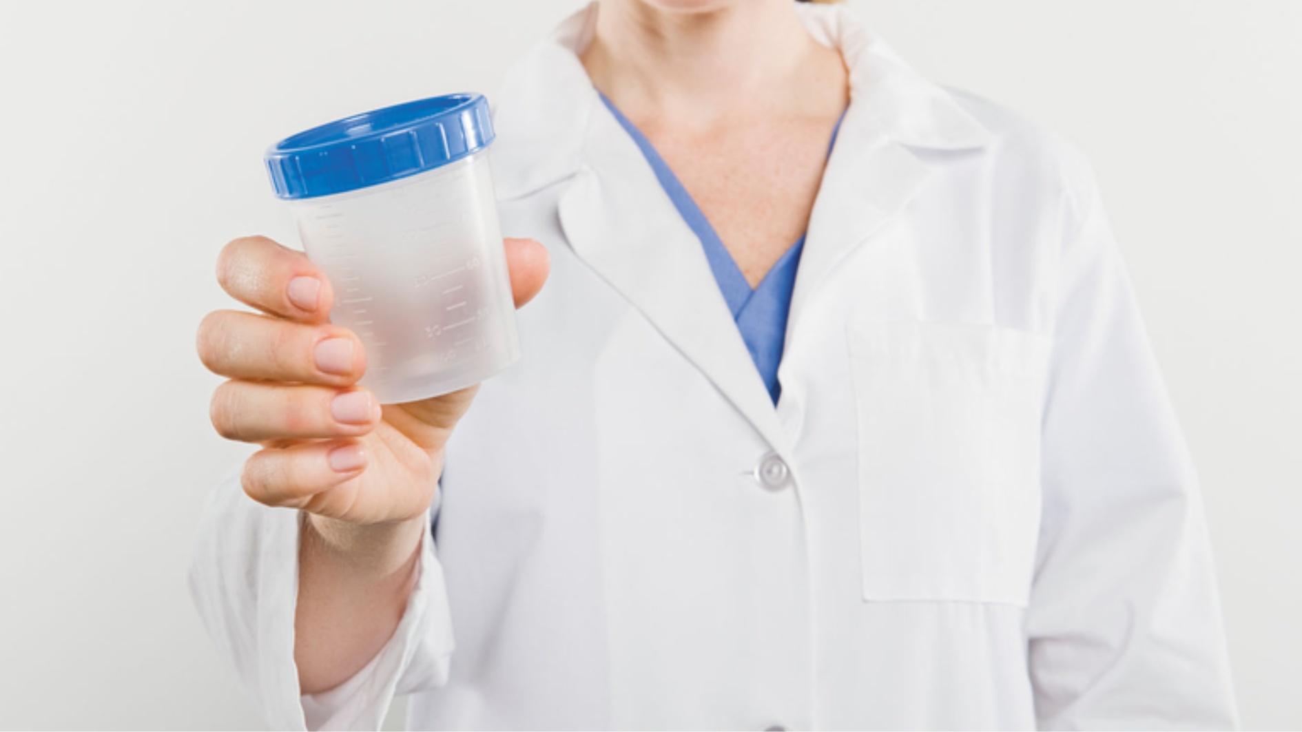 Bệnh nhân được phát dụng cụ đựng nước tiểu