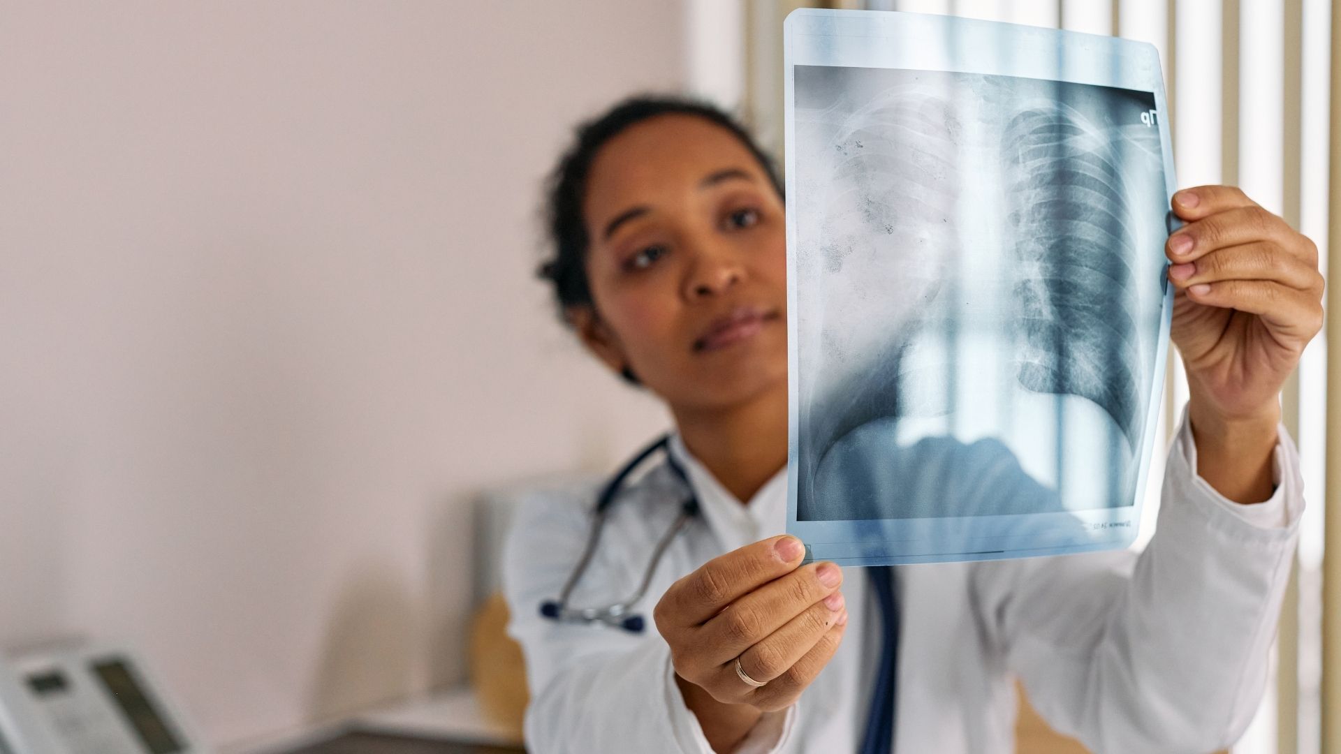 Liệt dây thanh âm gây biến chứng viêm phổi hít