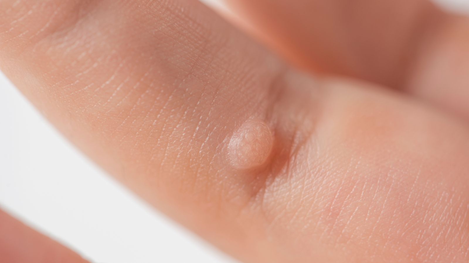 lieu-rang-sui-mao-ga-co-tu-khoi-khong-2