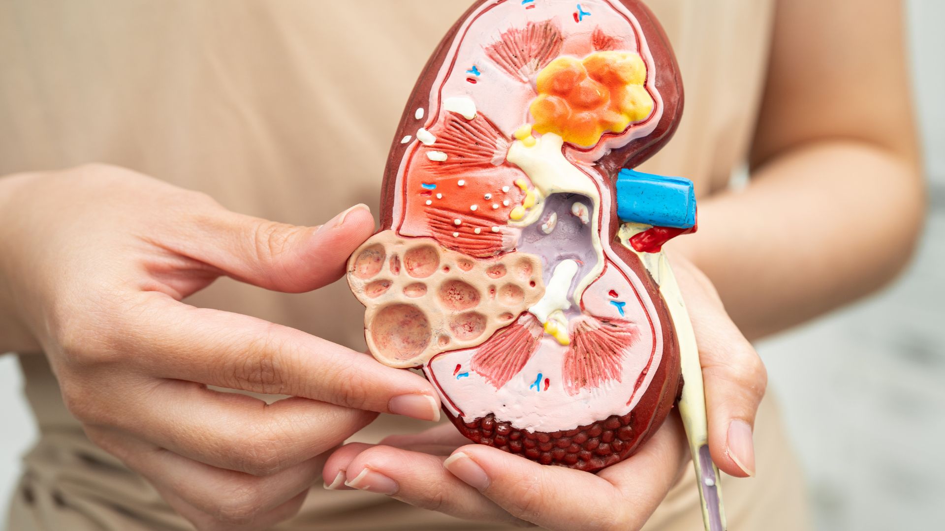 Suy thận mạn tính là một trong những yếu tố ảnh hưởng đến Lipoprotein(a)