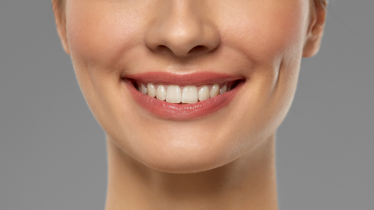 Má lúm đồng tiền là những vết lõm nhỏ đáng yêu xuất hiện trên má khi cười