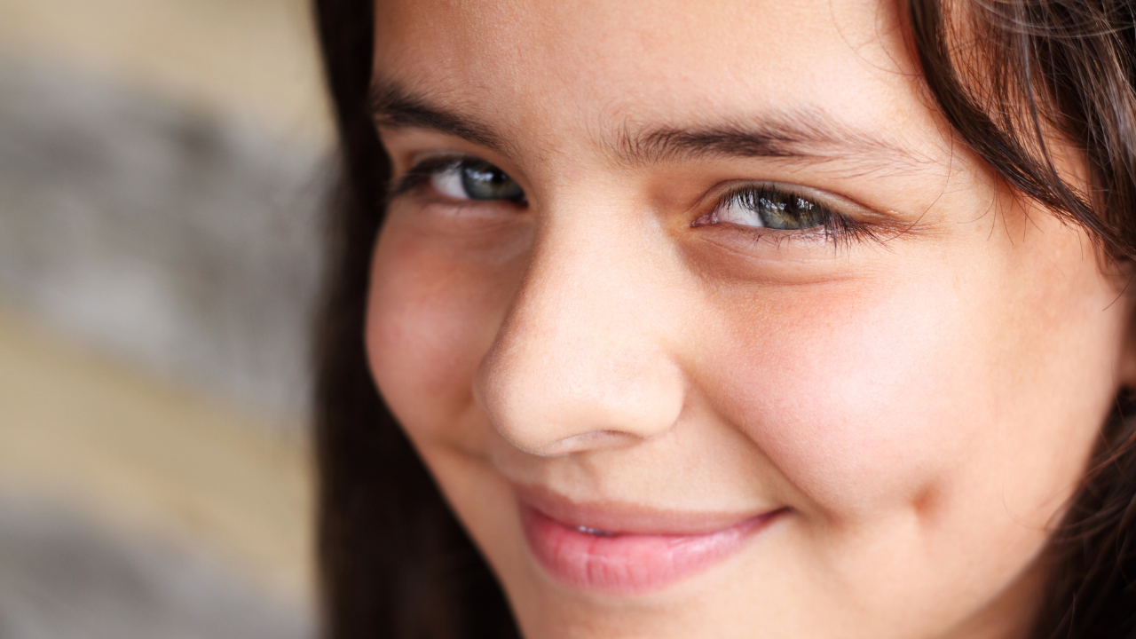 Má lúm đồng tiền là gen trội hay lặn?