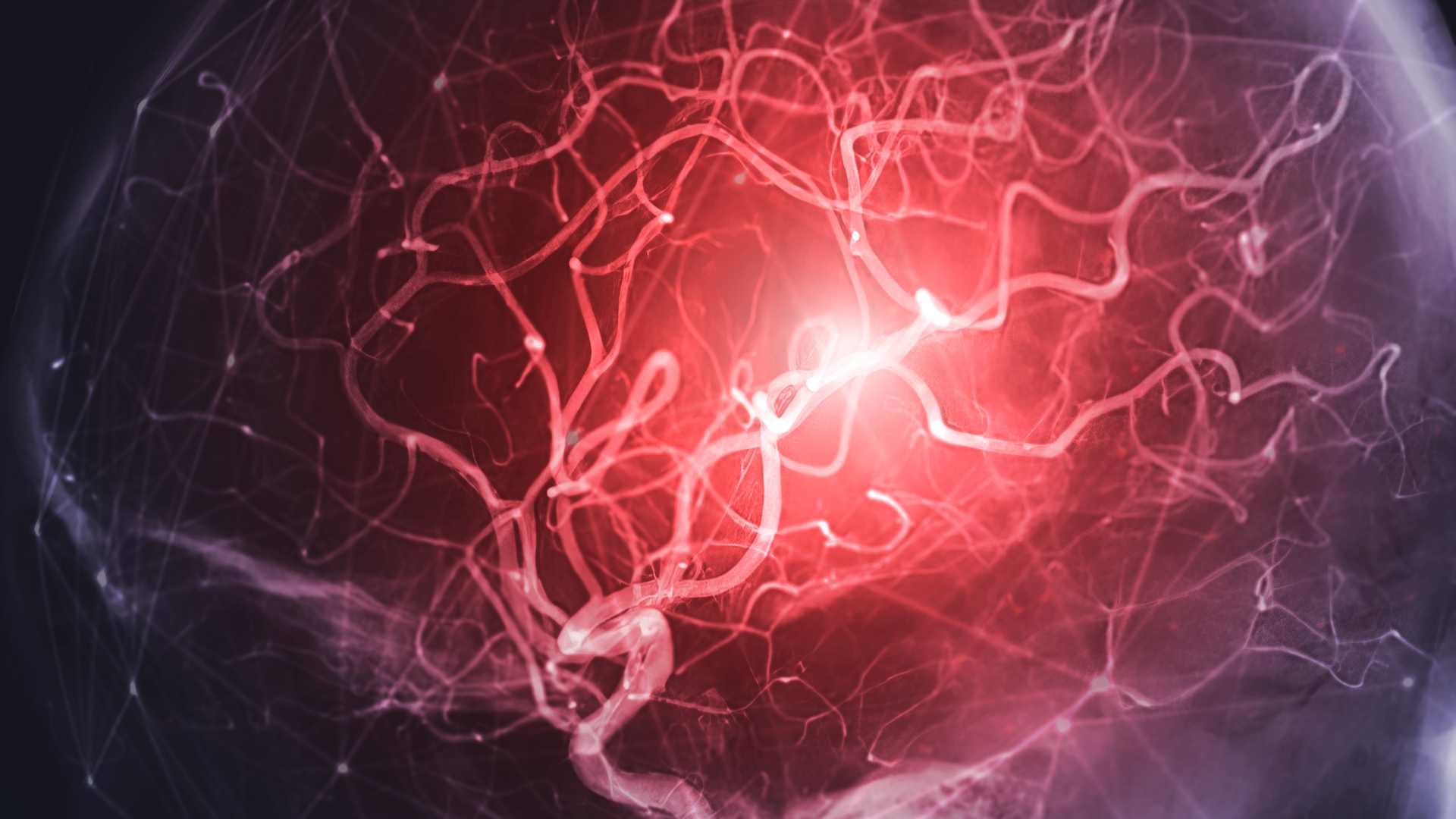 Xuất huyết não là một trong những bệnh lý về não nguy hiểm cần được cấp cứu can thiệp ngay