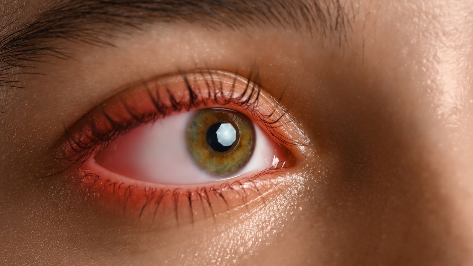 Các bệnh liên quan đến màng bồ đào có thể tác động đến thị lực và sức khỏe mắt