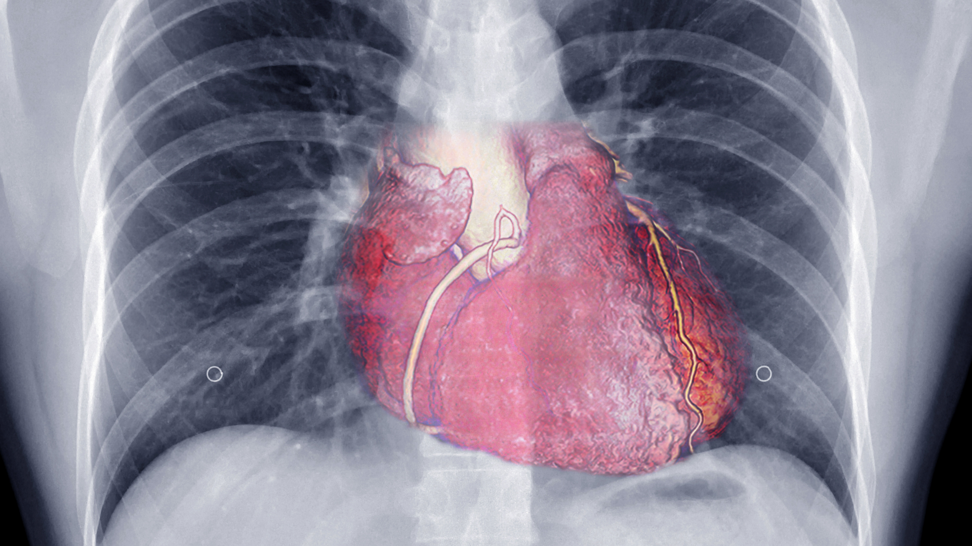 Cơ chế hoạt động của màng phổi trong hô hấp