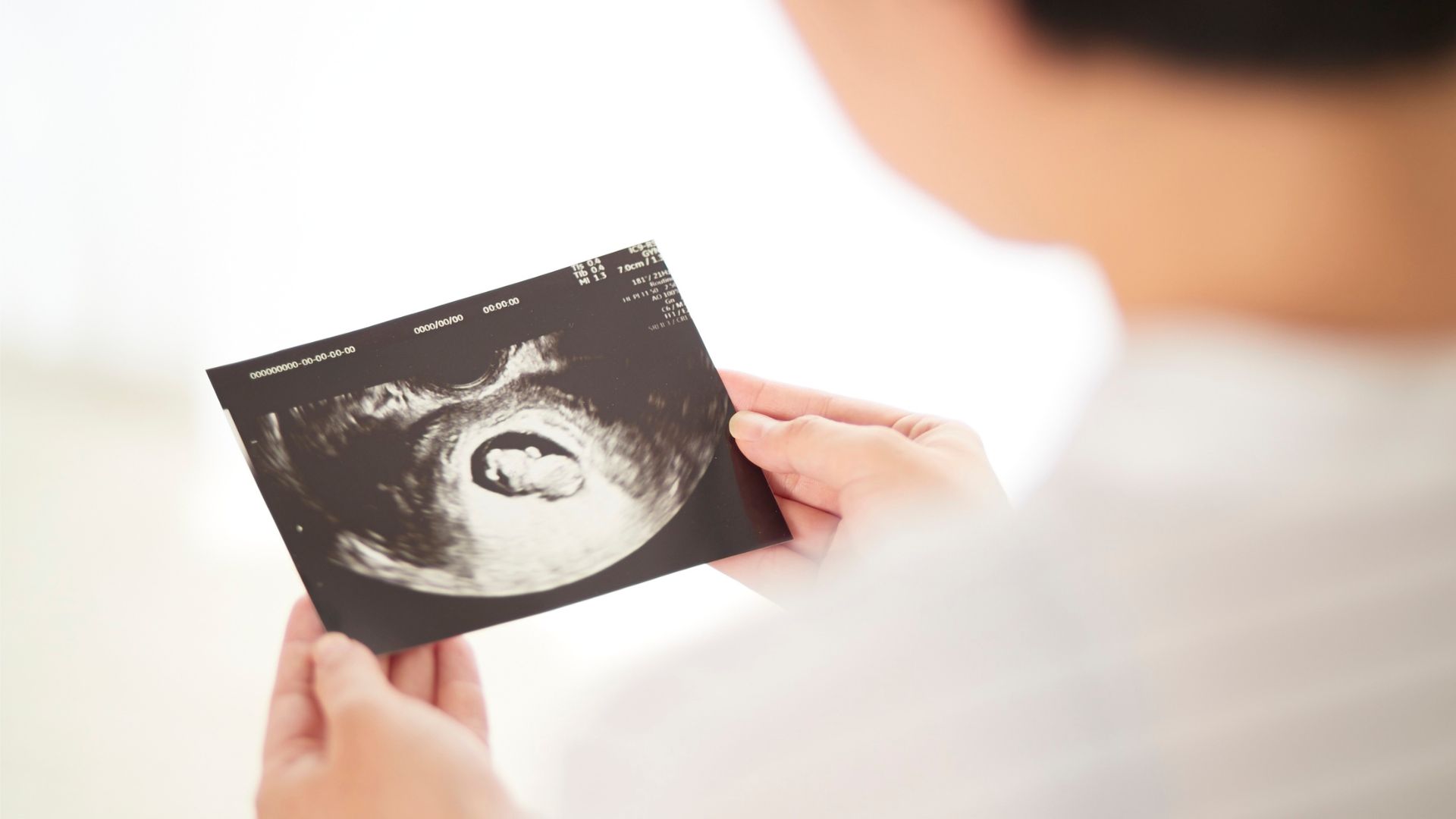 Siêu âm thai giúp ước tính tuổi thai một cách chính xác