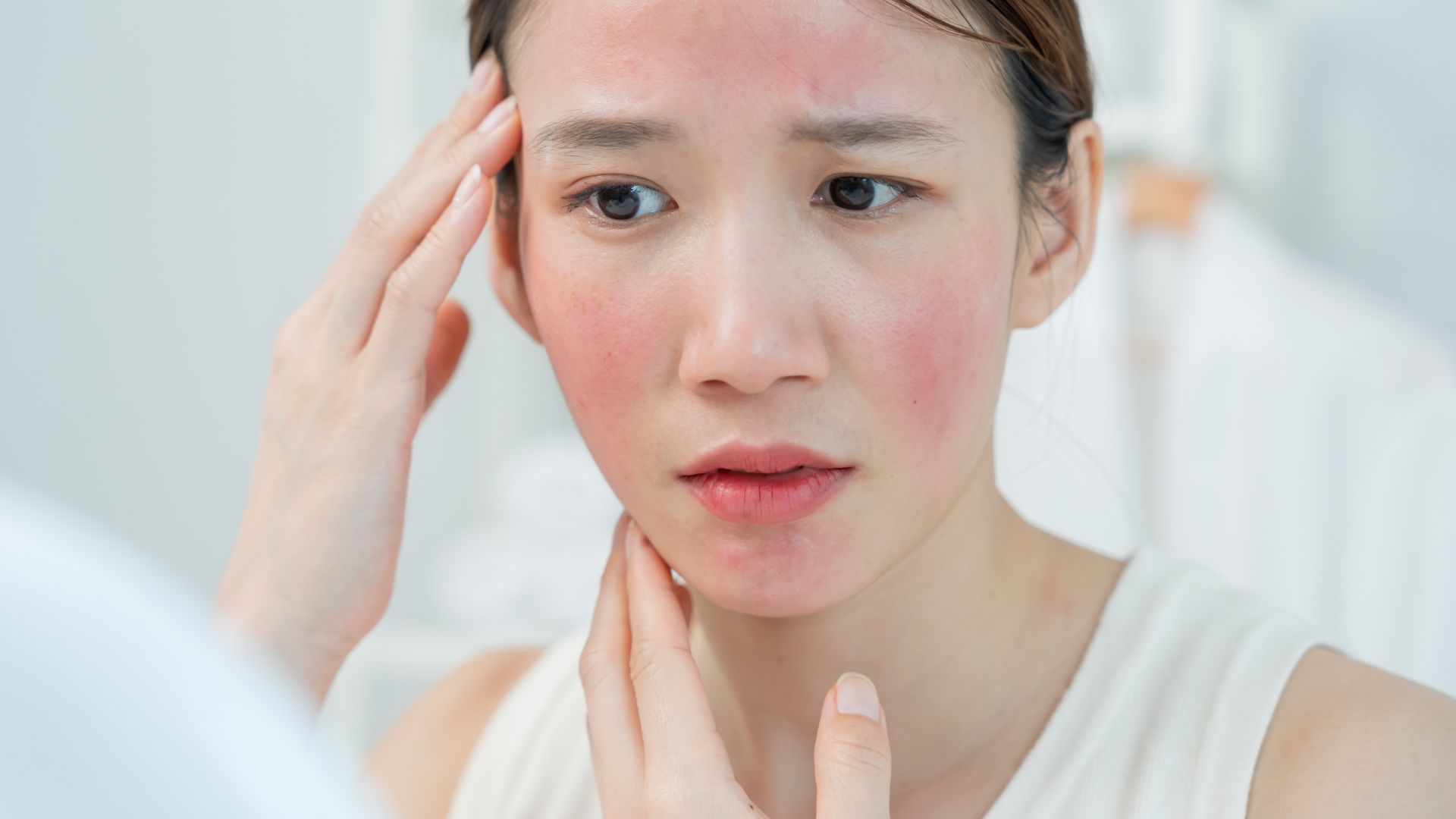 Viêm mao mạch dị ứng là một bệnh lý khá phổ biến