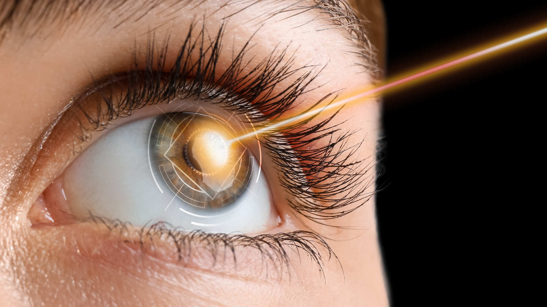 Nhiều kỹ thuật phẫu thuật cườm nước đang được áp dụng trong điều trị hiện nay