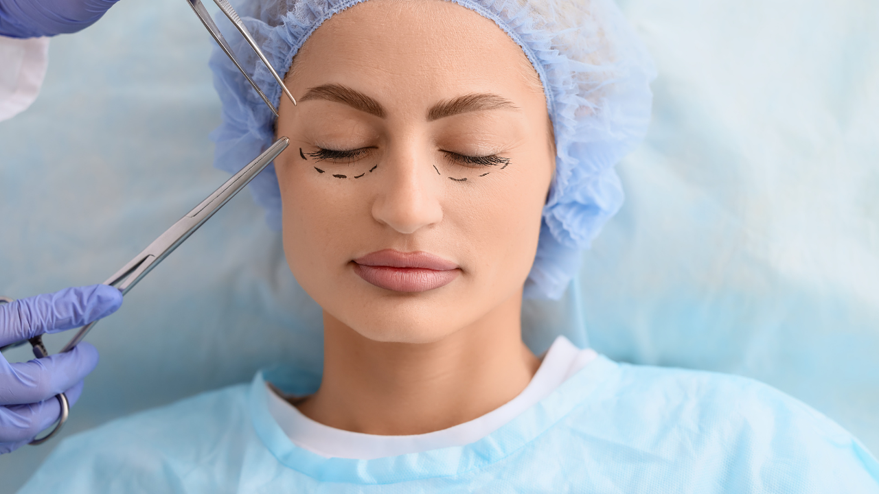 Phẫu thuật cắt mí xử lý các khuyết điểm khác như da thừa, sụp mí hay mỡ thừa vùng mắt