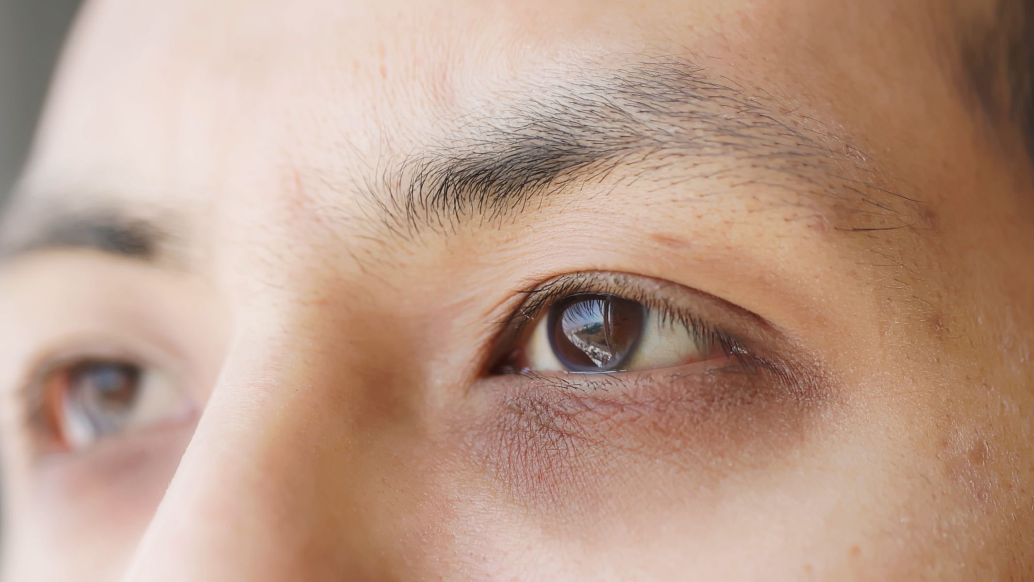 Mắt thâm​ quầng do đâu?