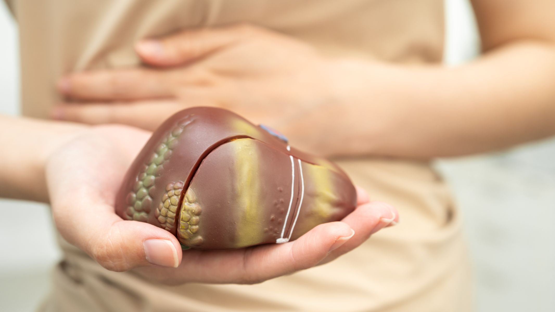 Các bệnh lý gan mạn tính như viêm gan, xơ gan có thể gây rối loạn chuyển hóa bilirubin và sắc tố, dẫn đến biểu hiện thâm quầng mắt