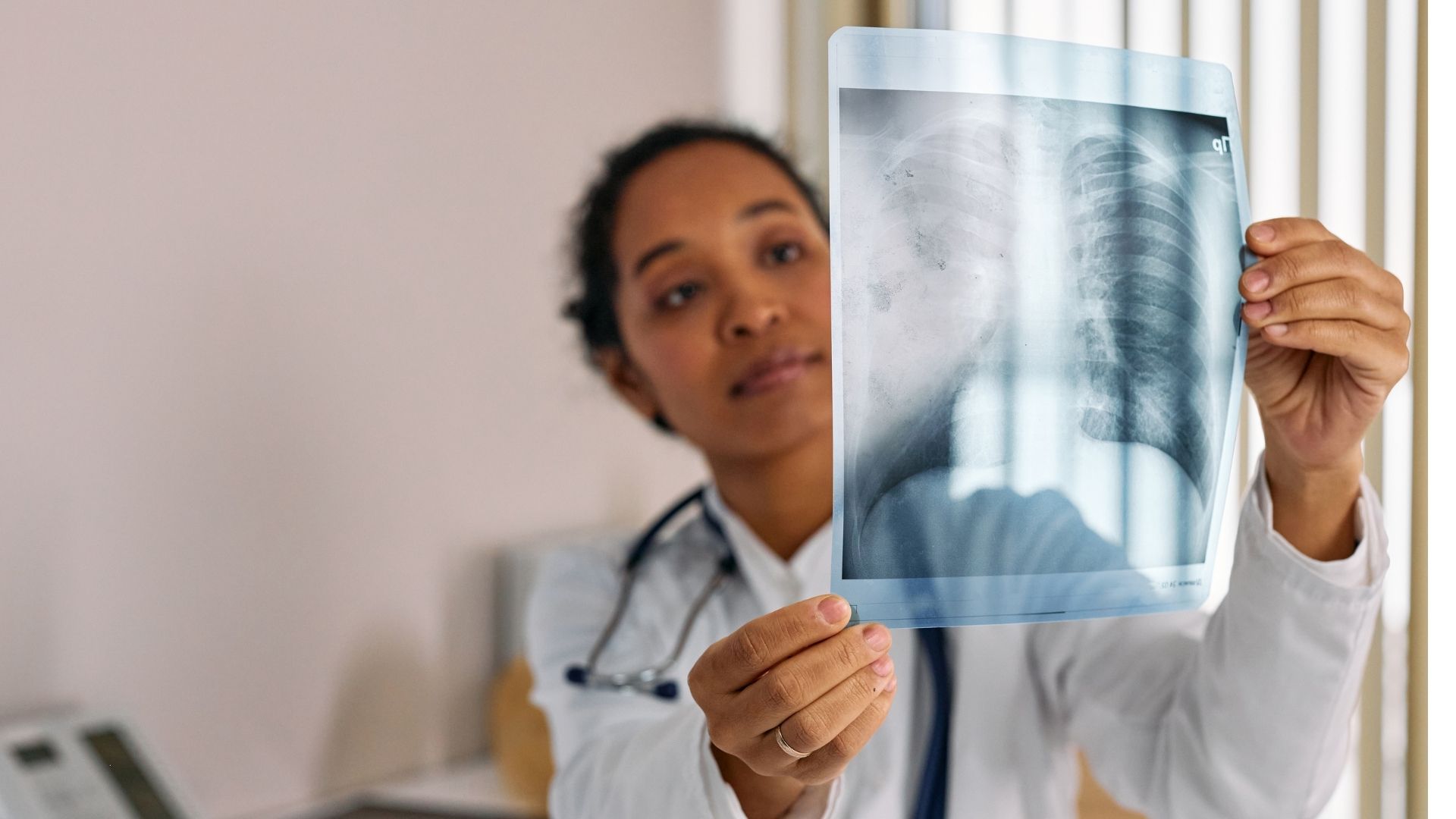 Chứng mất trí nhớ tăng nguy cơ mắc bệnh viêm phổi hít