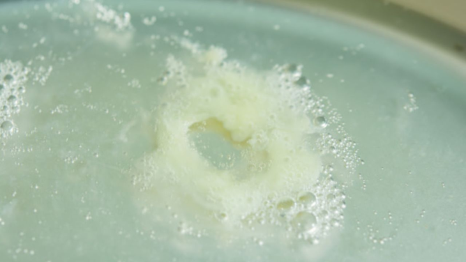 Trắng đục là màu đờm thể hiện dấu hiệu phổ biến của nghẹt mũi hoặc viêm xoang