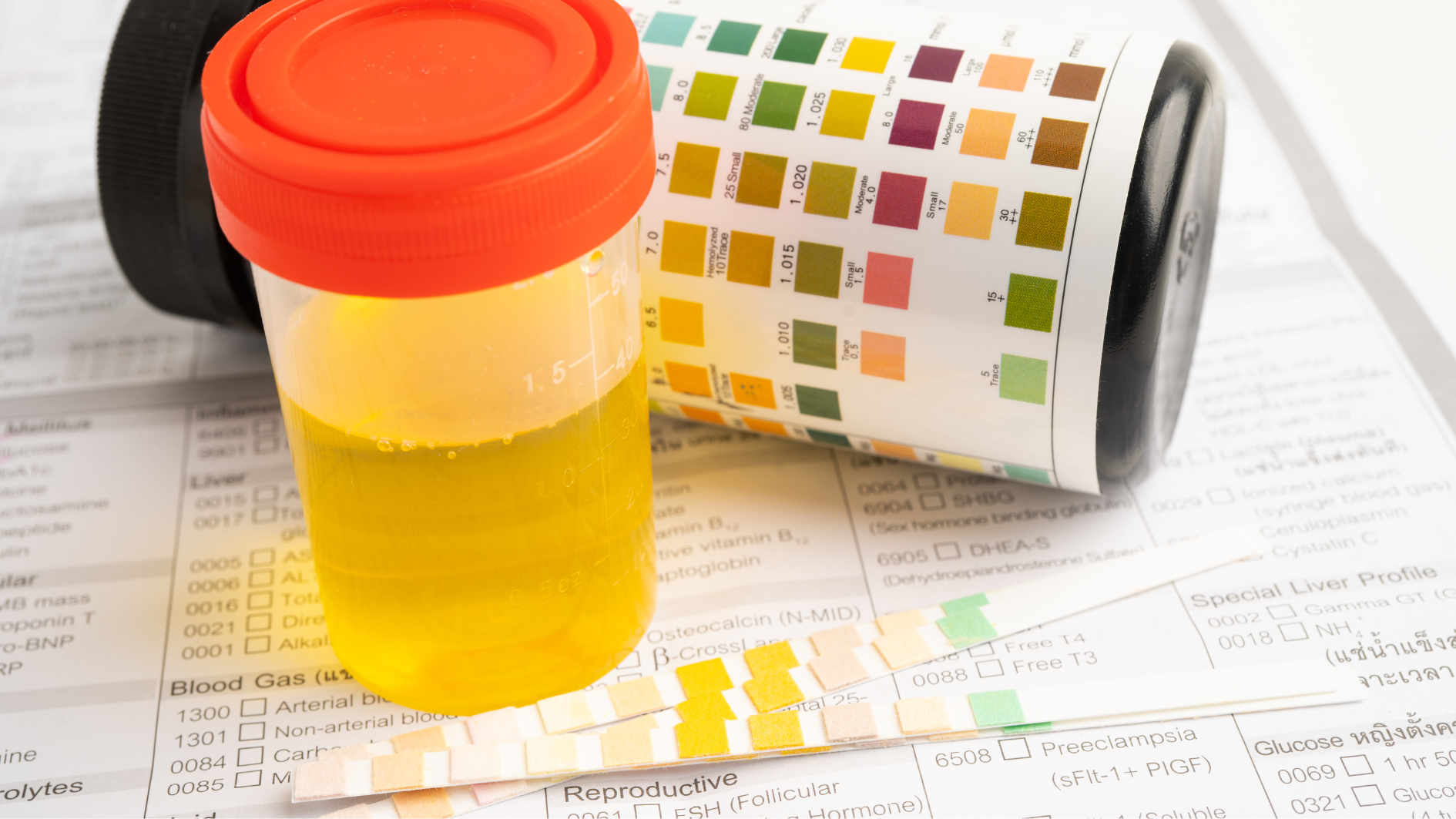 Màu nước tiểu trẻ sơ sinh tùy thuộc vào nhiều yếu tố