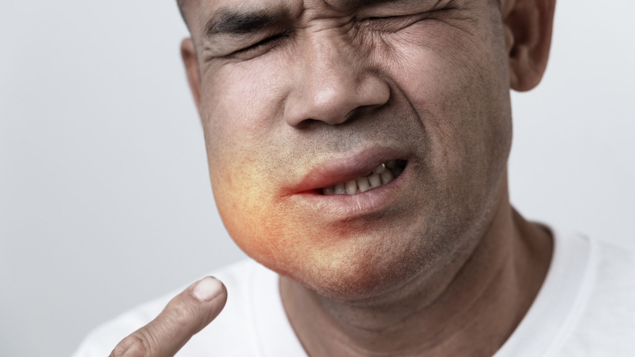 Khi phù lan đến vùng niêm mạc họng có thể gặp khó thở, khàn tiếng, nuốt vướng