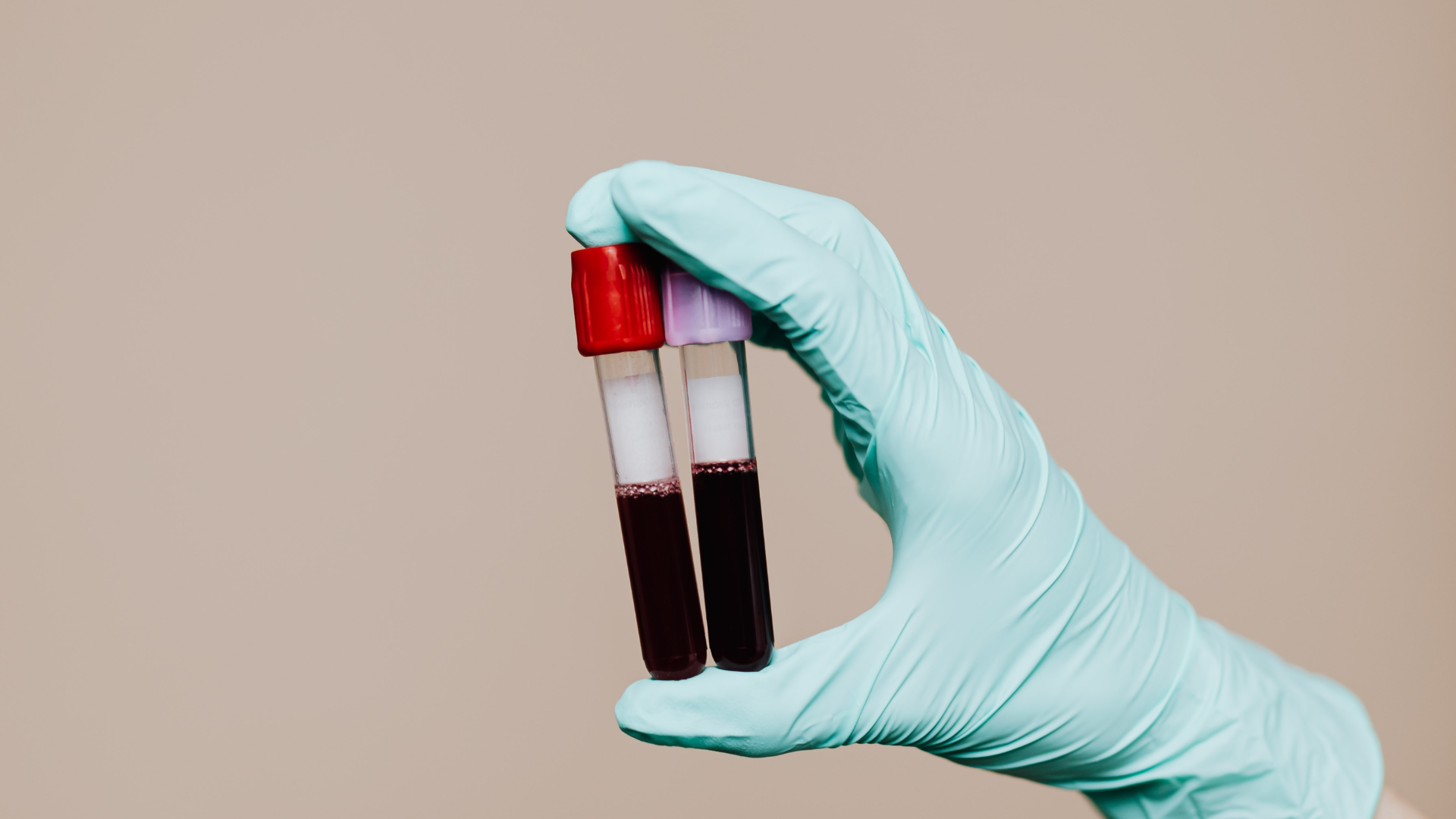 Sau sinh, trẻ sẽ được xét nghiệm nhóm máu để lưu thông tin vào hồ sơ y tế, giúp dễ dàng xử trí nếu trẻ cần truyền máu sau này