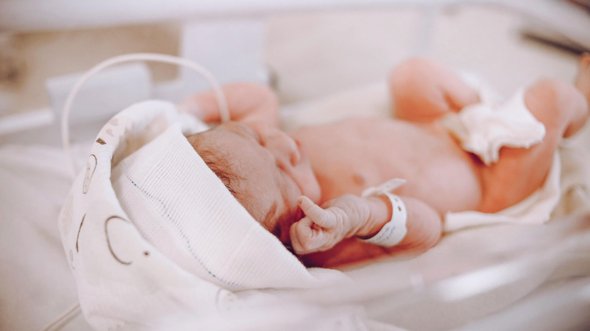 Bất thường giải phẫu bẩm sinh gây hiện tượng&nbsp;mềm sụn thanh quản​