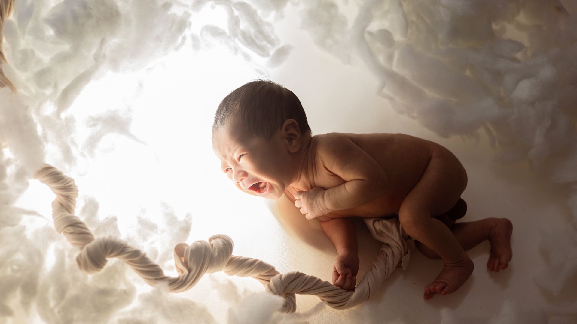 Bệnh&nbsp;mềm sụn thanh quản​ thường liên quan tới bệnh lý bẩm sinh