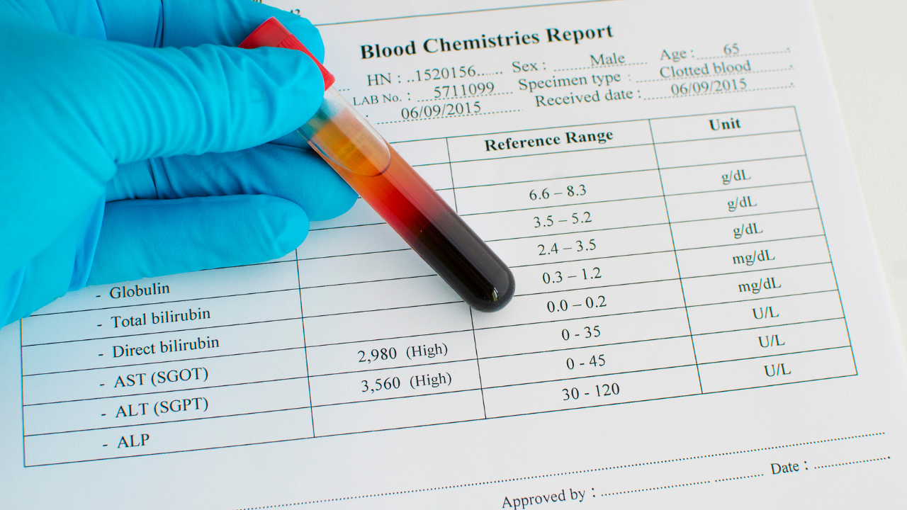 Men gan cao 1500 có nguy hiểm không?