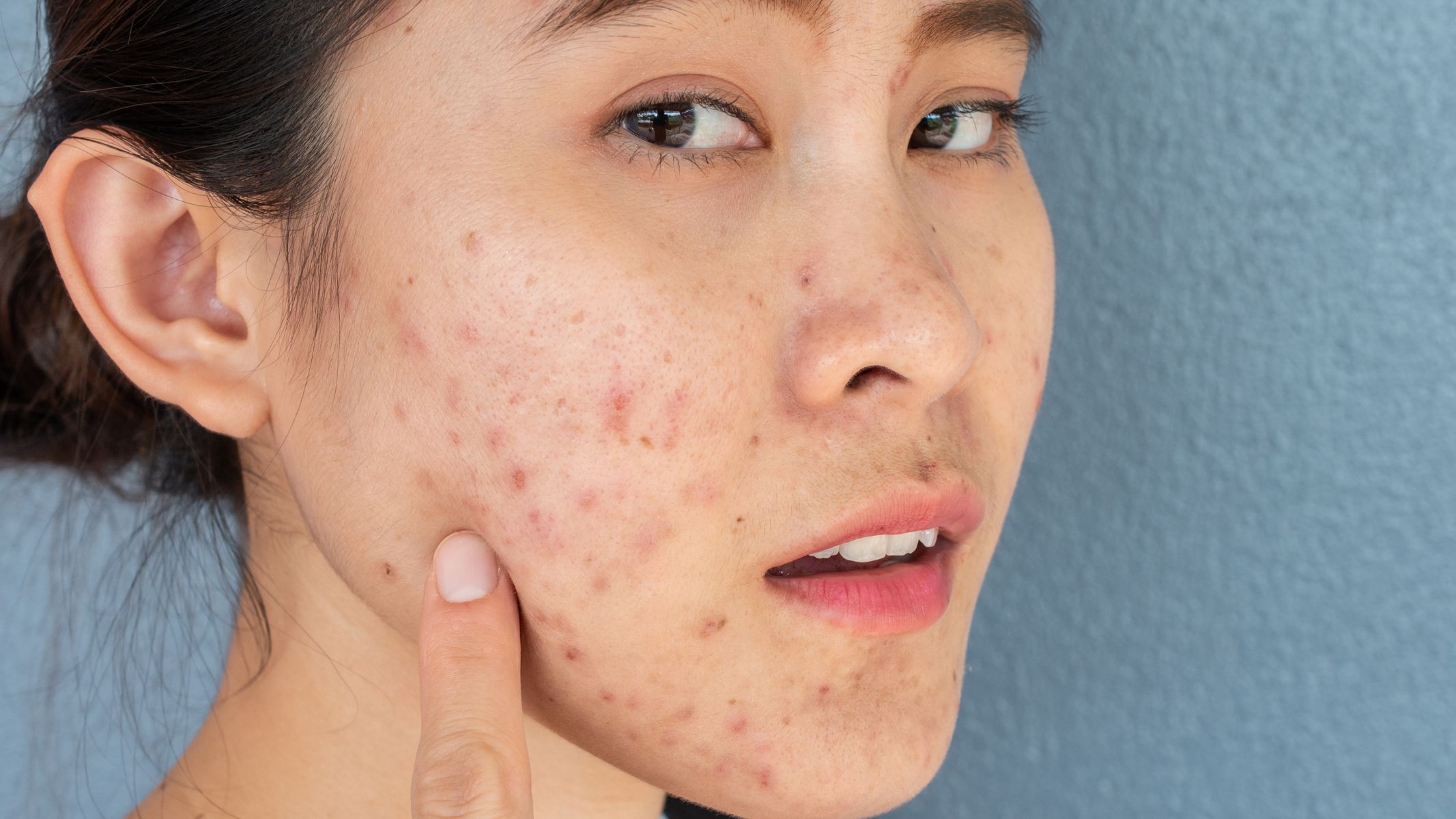 Mẹo nhận biết có thai theo dân gian có đúng không? Giải đáp chi tiết 2